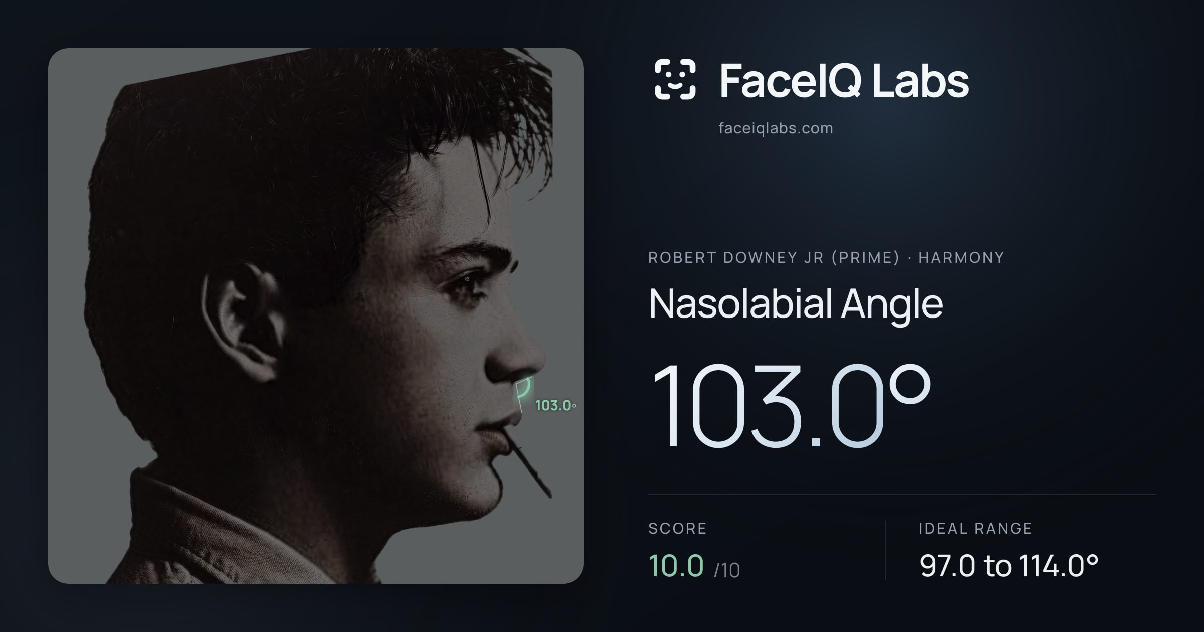 Robert Downey Jr (Prime) Nasolabial Angle: 103.0°, drawn on the photo