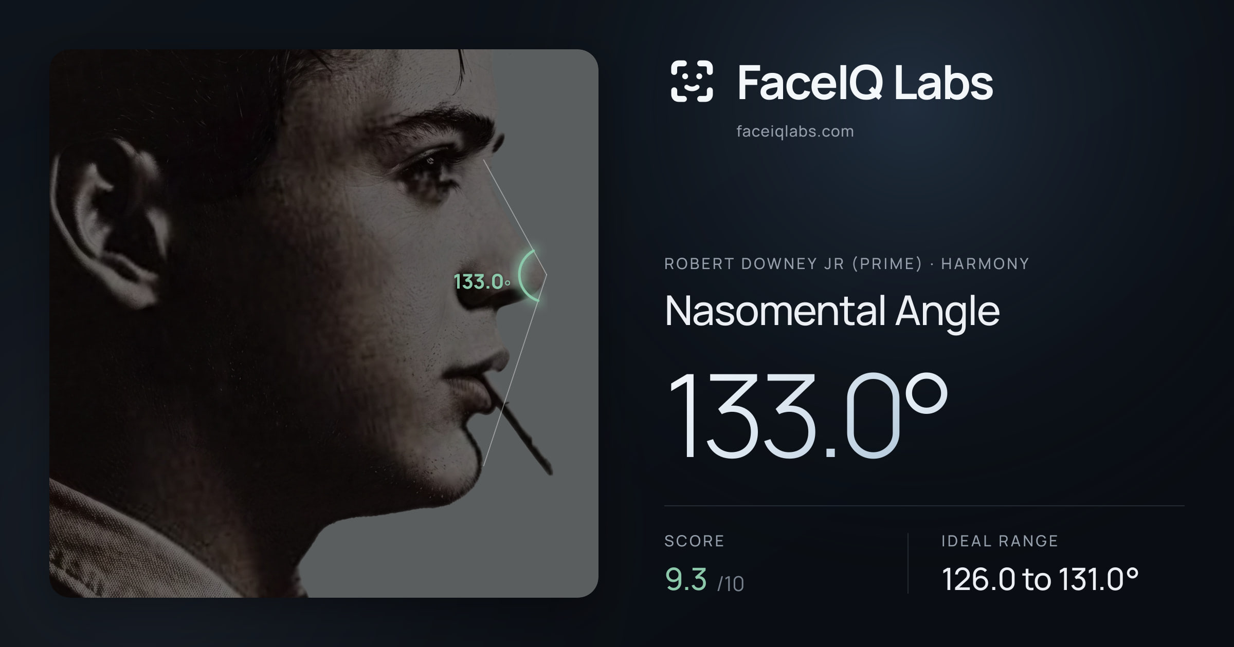 Robert Downey Jr (Prime) Nasomental Angle: 133.0°, drawn on the photo