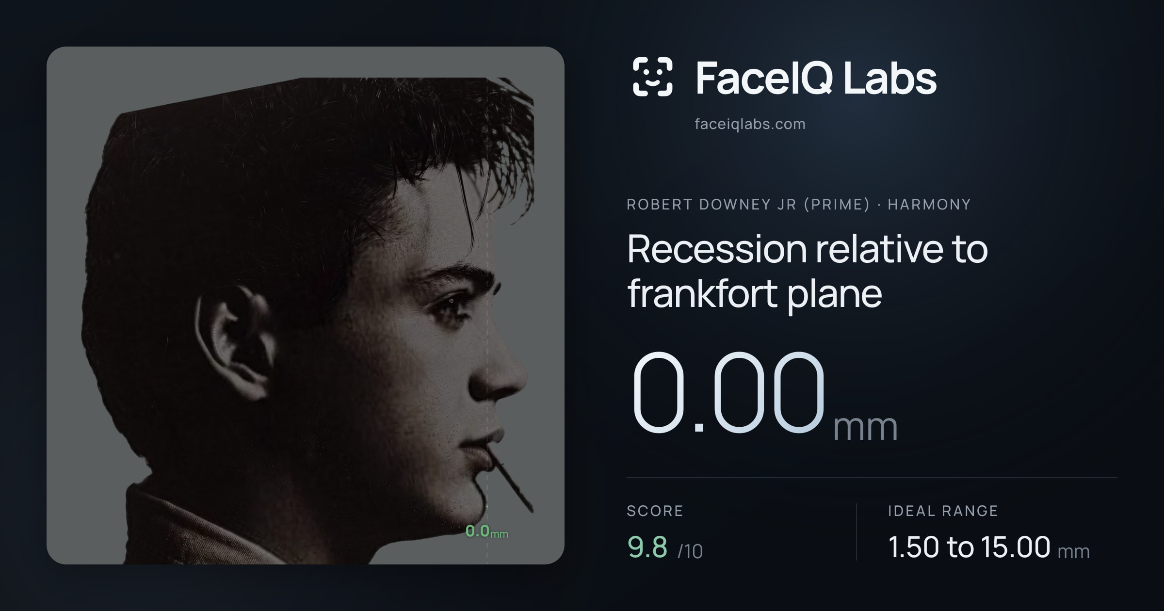 Robert Downey Jr (Prime) Recession relative to frankfort plane: 0.00mm, drawn on the photo