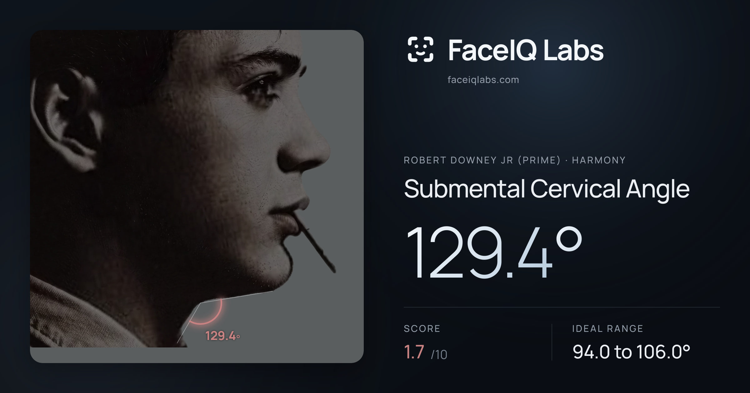 Robert Downey Jr (Prime) Submental Cervical Angle: 129.4°, drawn on the photo