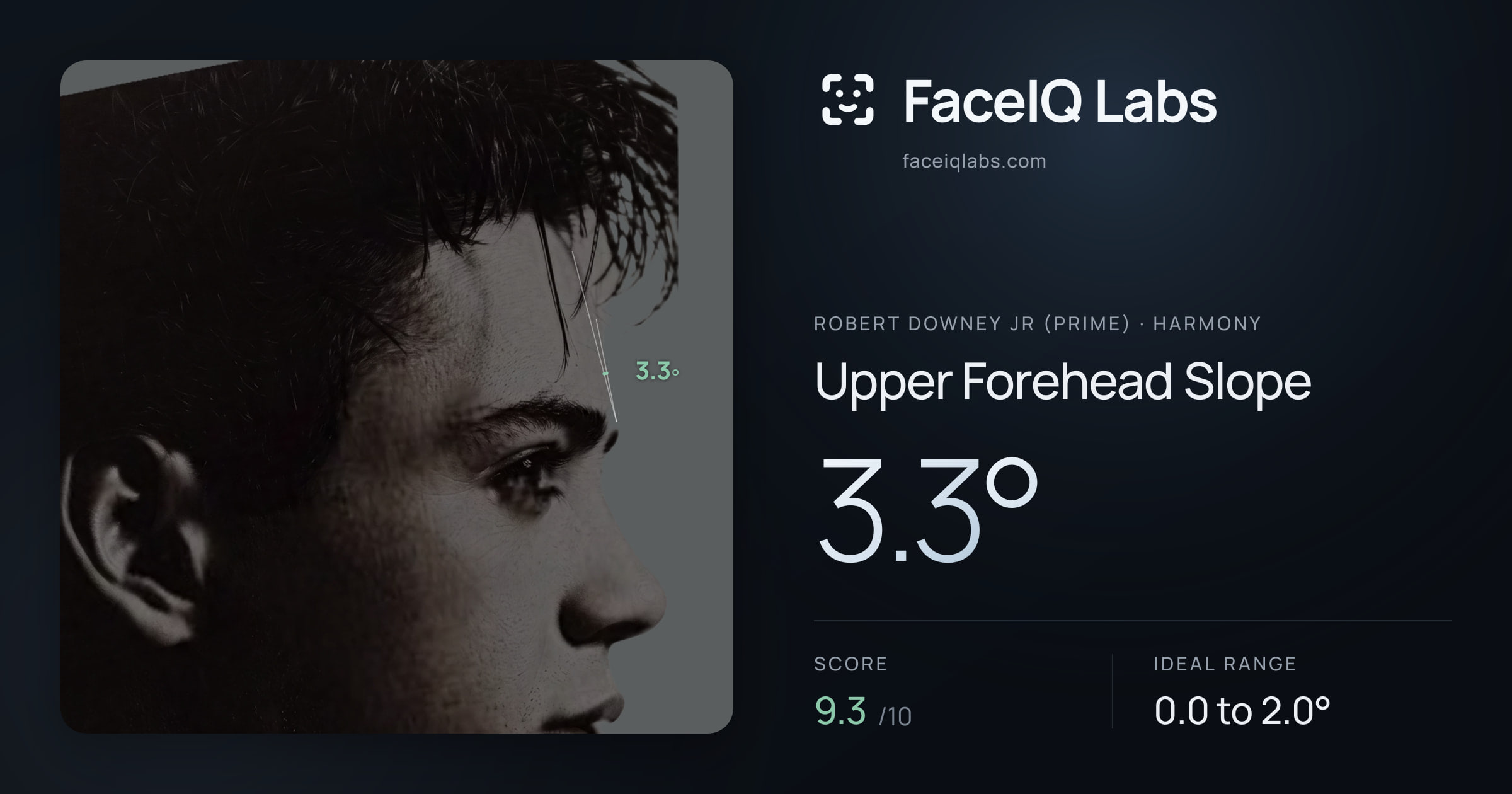 Robert Downey Jr (Prime) Upper Forehead Slope: 3.3°, drawn on the photo