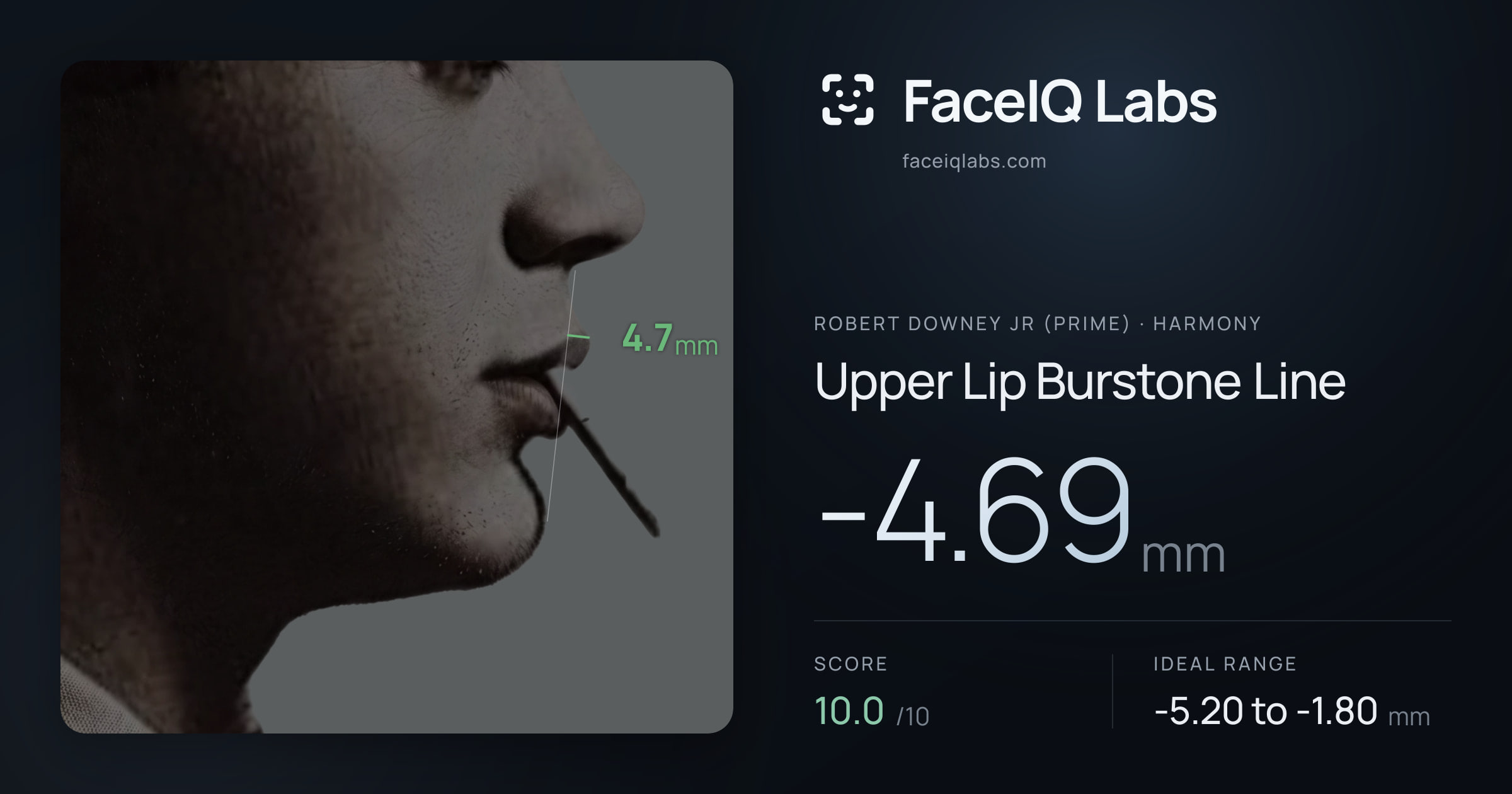 Robert Downey Jr (Prime) Upper Lip Burstone Line: -4.69mm, drawn on the photo