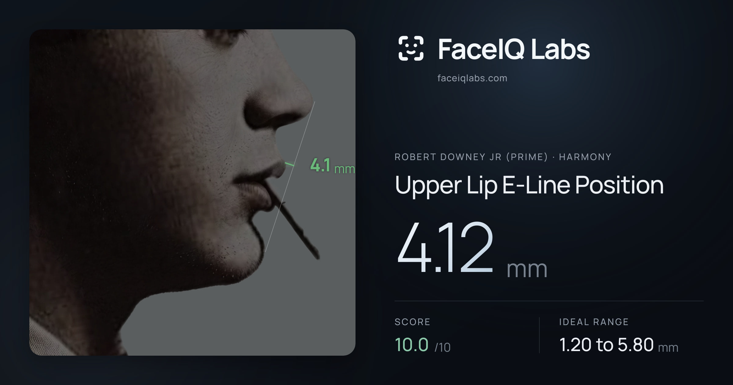 Robert Downey Jr (Prime) Upper Lip E-Line Position: 4.12mm, drawn on the photo