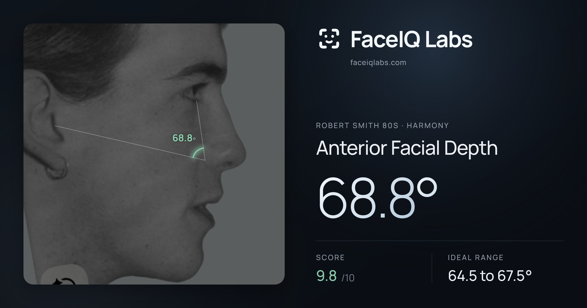 Robert Smith 80s Anterior Facial Depth: 68.8°, drawn on the photo