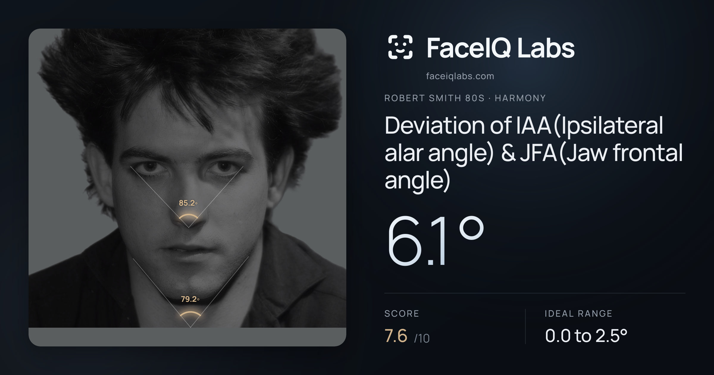 Robert Smith 80s Deviation of IAA(Ipsilateral alar angle) & JFA(Jaw frontal angle): 6.1°, drawn on the photo