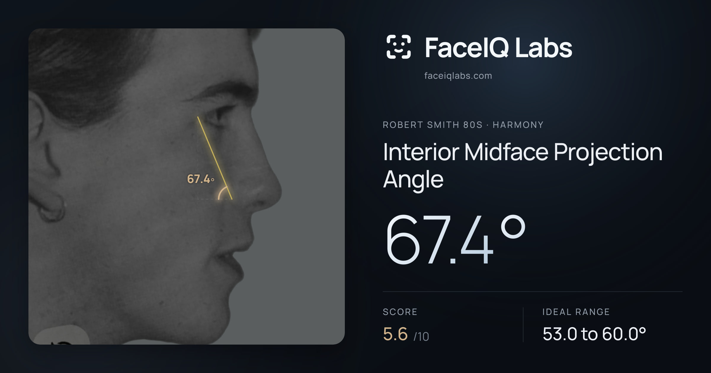 Robert Smith 80s Interior Midface Projection Angle: 67.4°, drawn on the photo