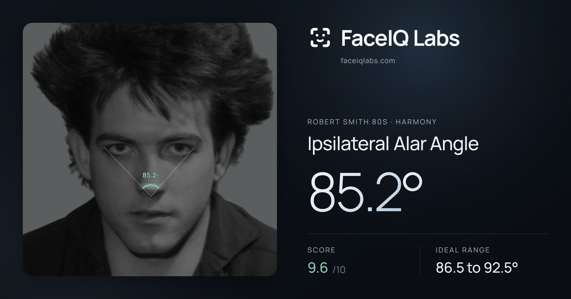 Robert Smith 80s Ipsilateral Alar Angle: 85.2°, drawn on the photo