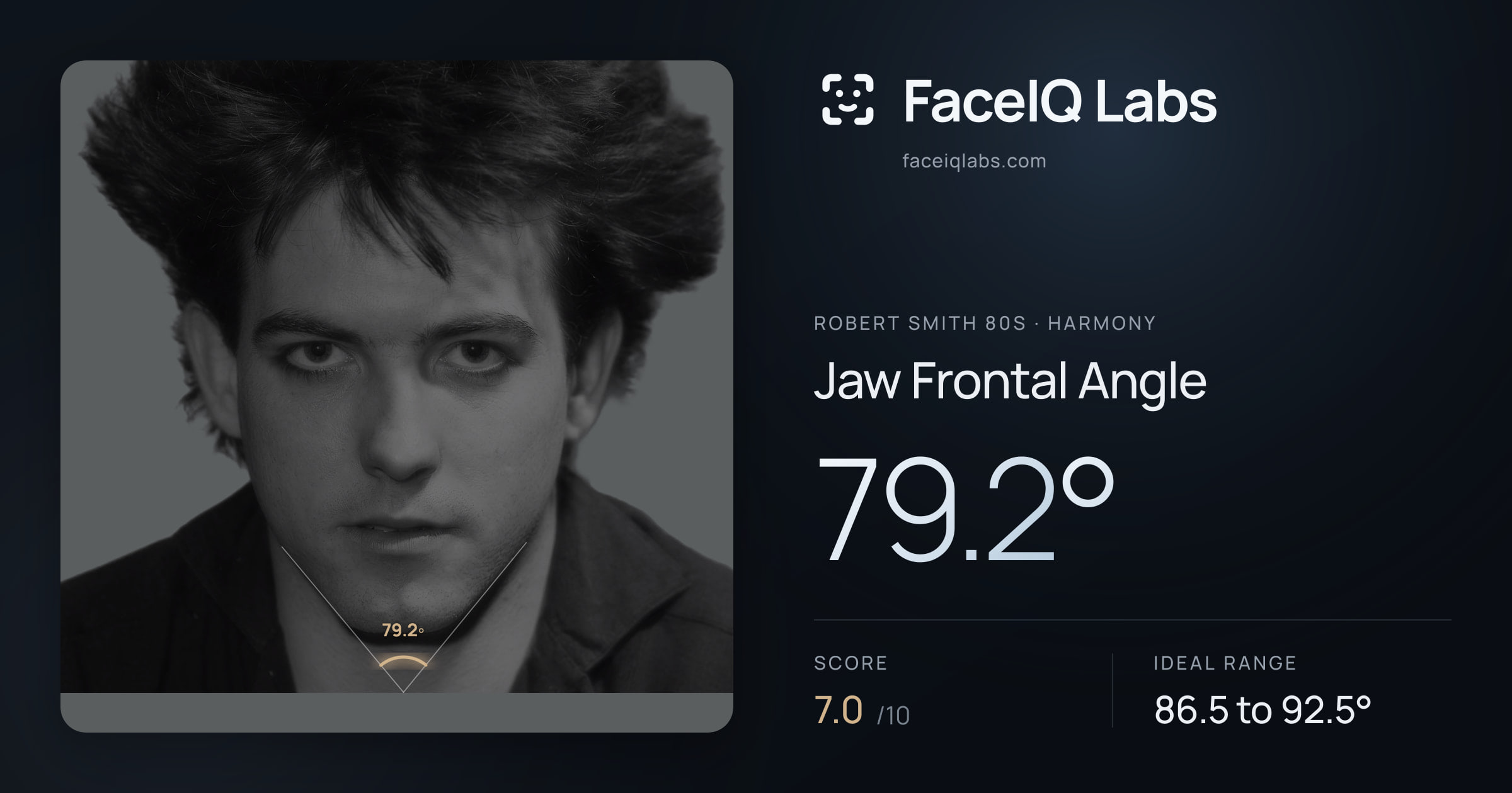 Robert Smith 80s Jaw Frontal Angle: 79.2°, drawn on the photo