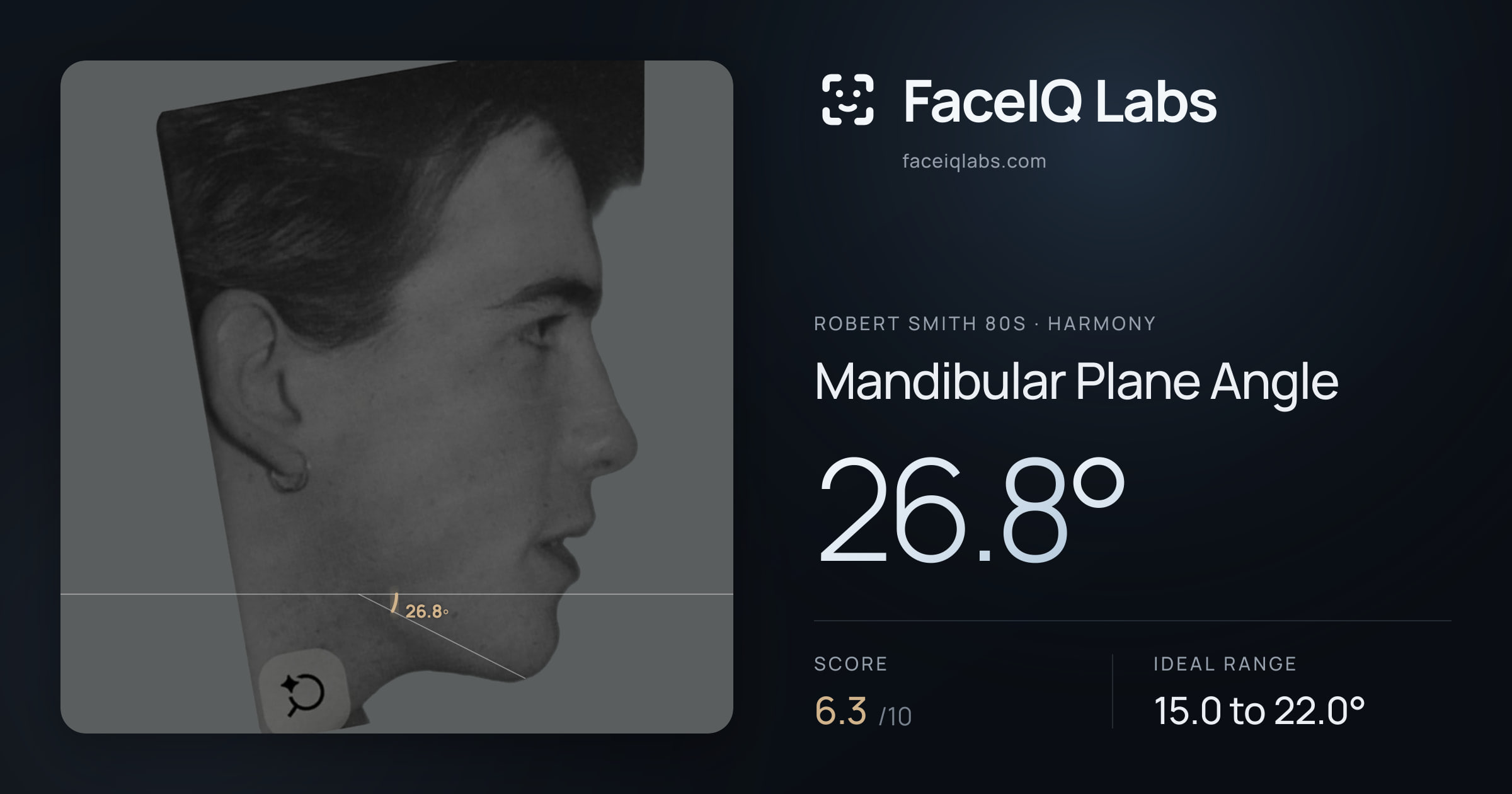 Robert Smith 80s Mandibular Plane Angle: 26.8°, drawn on the photo
