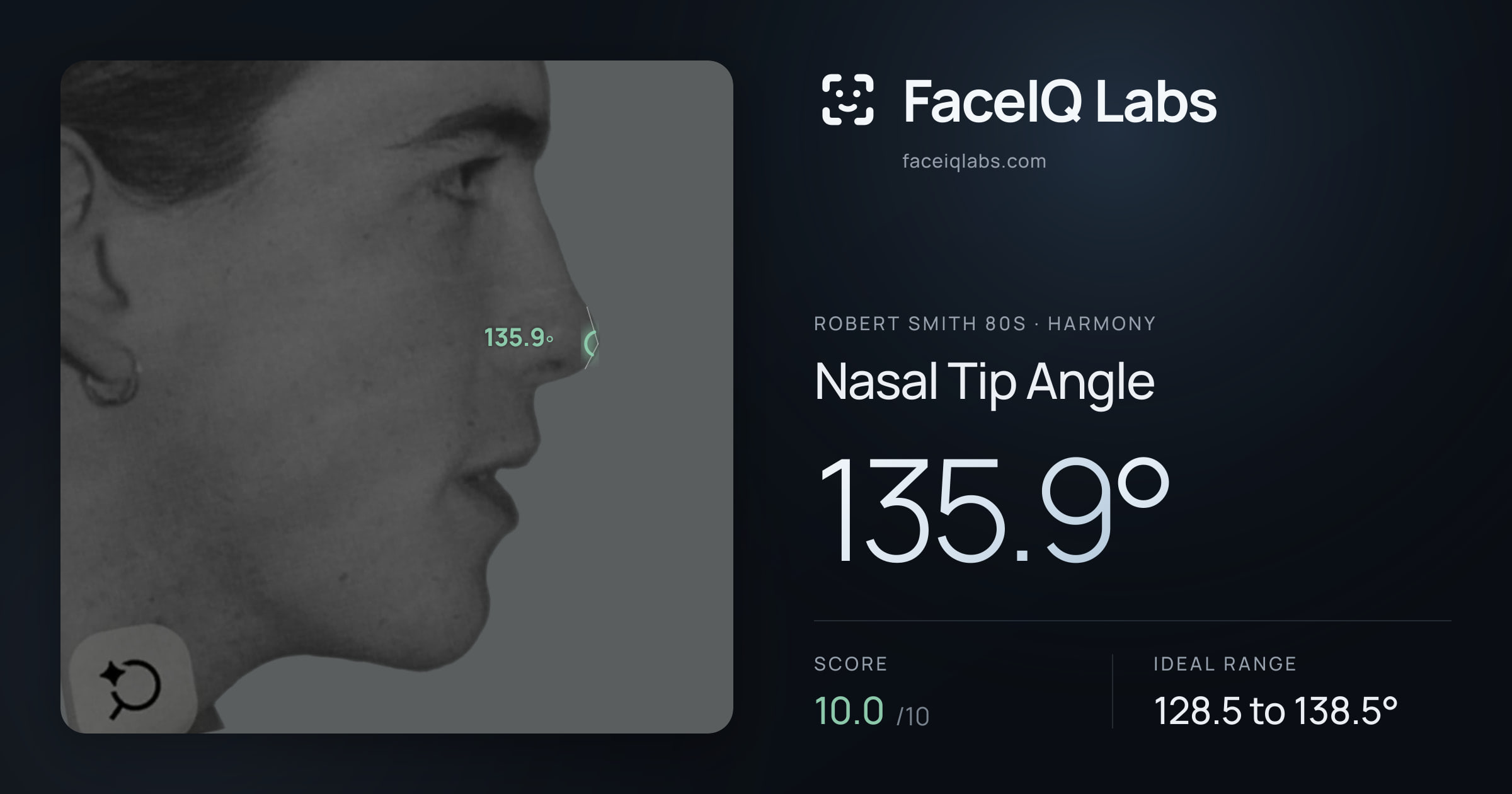 Robert Smith 80s Nasal Tip Angle: 135.9°, drawn on the photo