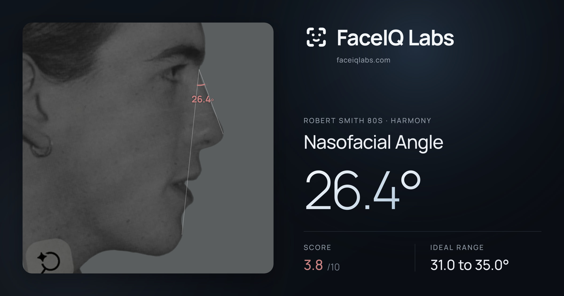 Robert Smith 80s Nasofacial Angle: 26.4°, drawn on the photo