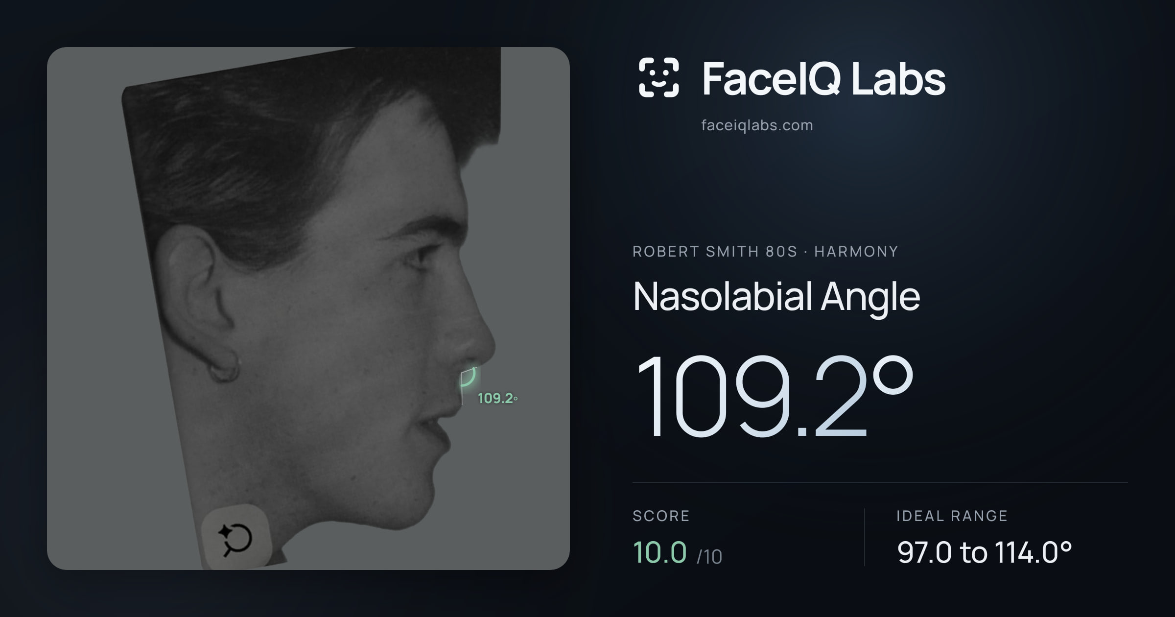 Robert Smith 80s Nasolabial Angle: 109.2°, drawn on the photo