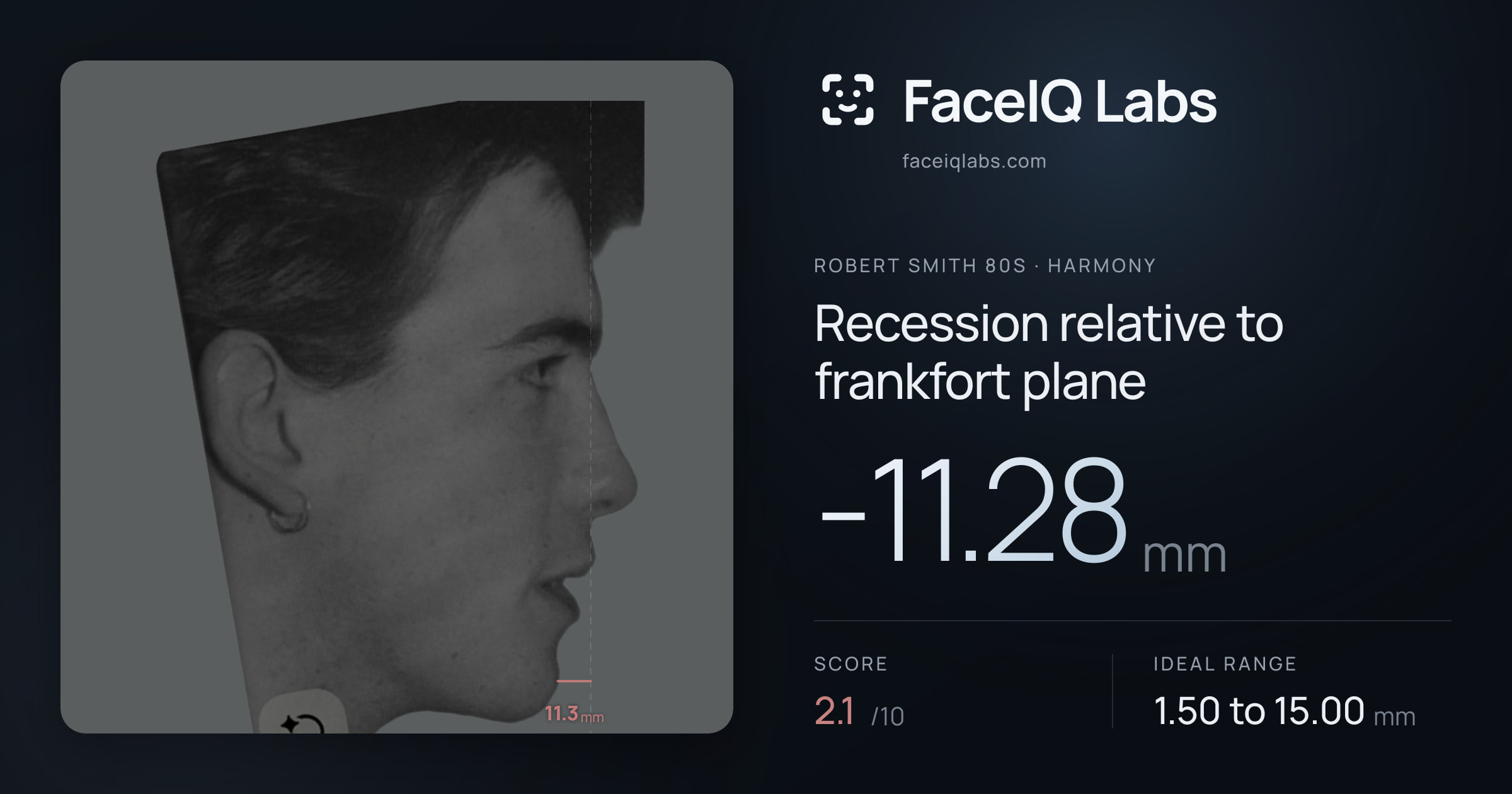 Robert Smith 80s Recession relative to frankfort plane: -11.28mm, drawn on the photo
