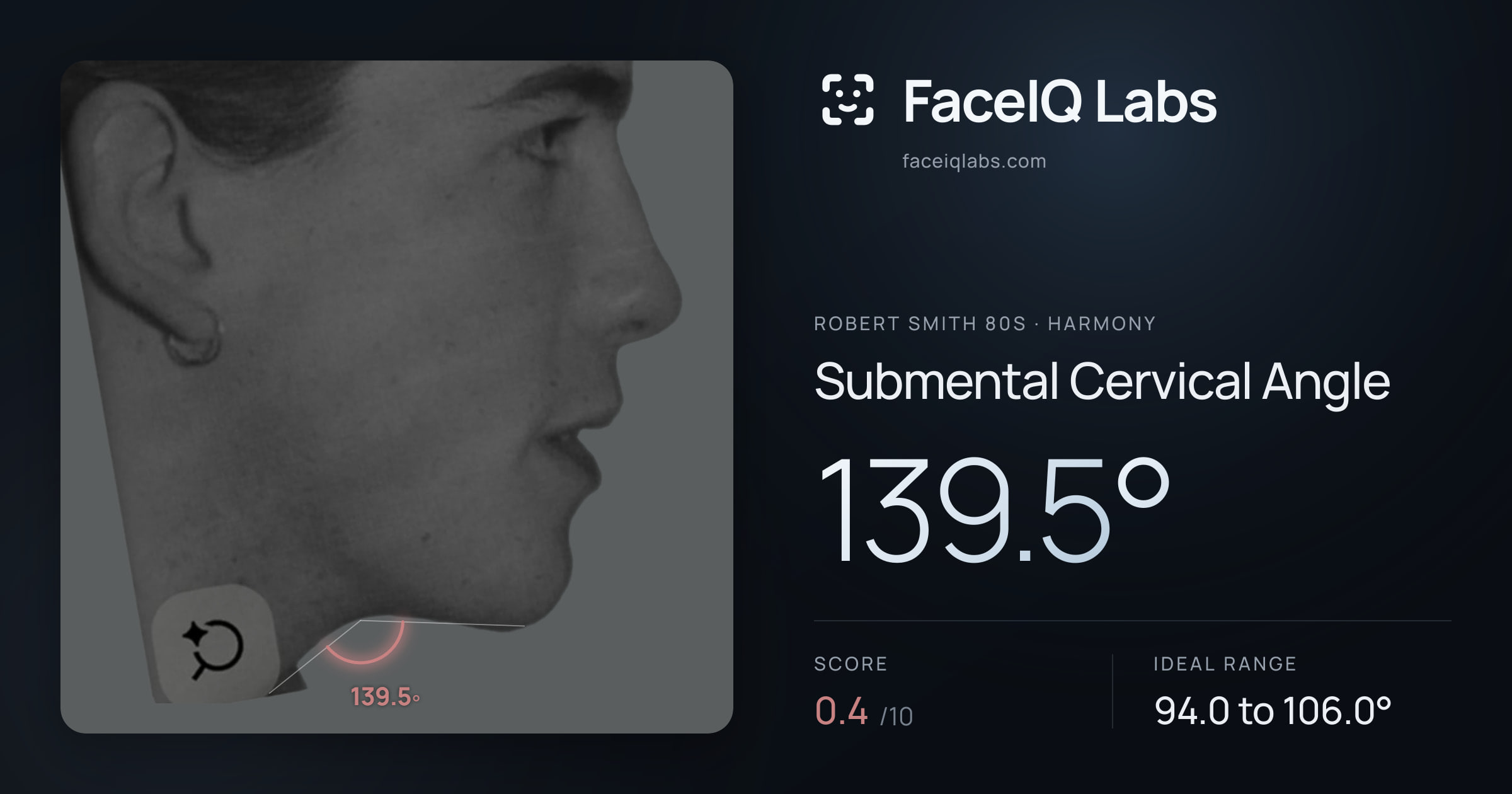 Robert Smith 80s Submental Cervical Angle: 139.5°, drawn on the photo