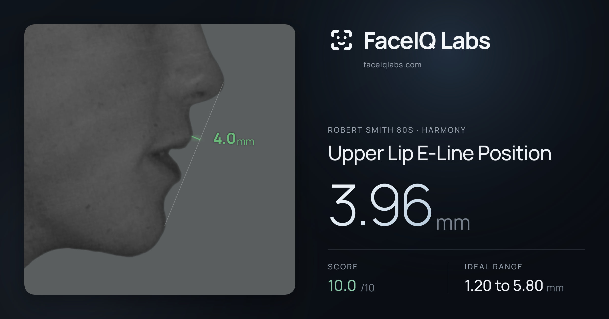 Robert Smith 80s Upper Lip E-Line Position: 3.96mm, drawn on the photo