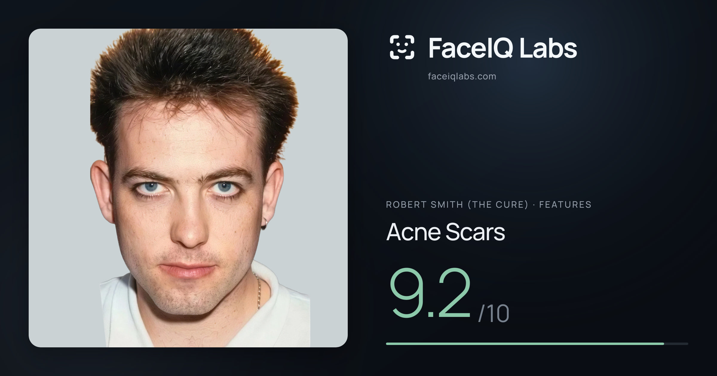 Robert Smith (The cure) Acne Scars: 9.2/10, drawn on the photo