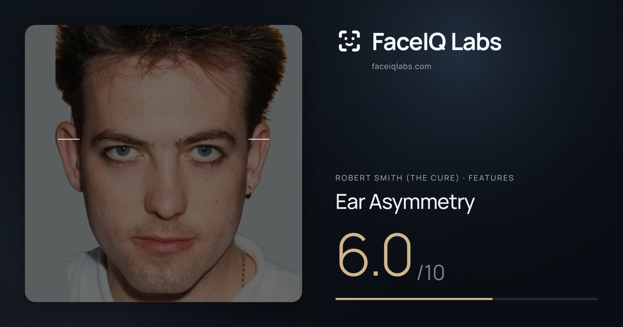 Robert Smith (The cure) Ear Asymmetry: 6.0/10, drawn on the photo