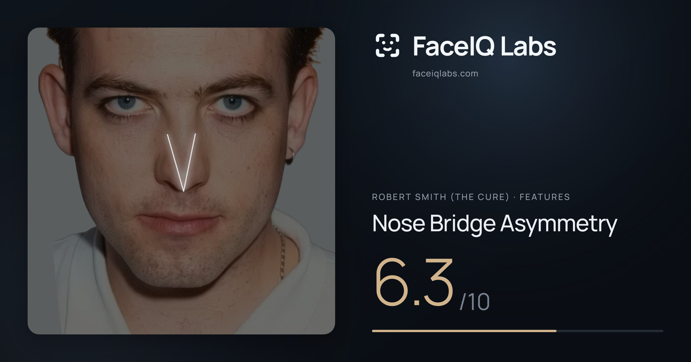 Robert Smith (The cure) Nose Bridge Asymmetry: 6.3/10, drawn on the photo