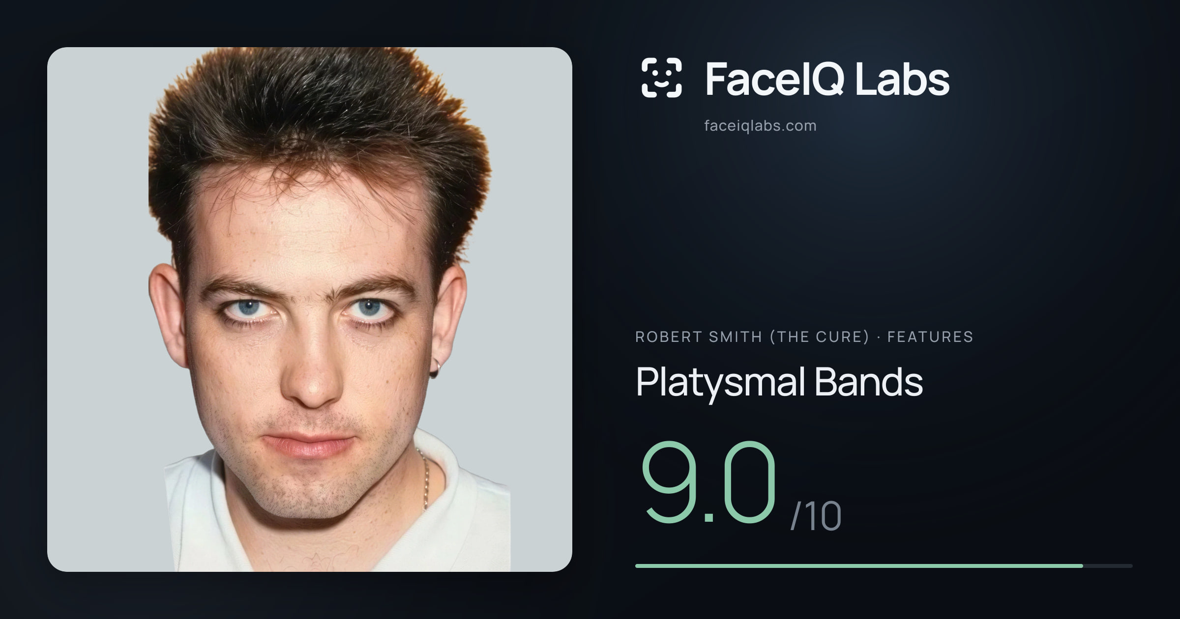 Robert Smith (The cure) Platysmal Bands: 9.0/10, drawn on the photo