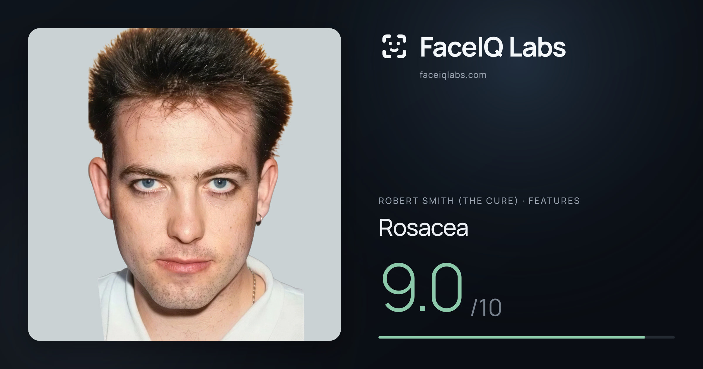 Robert Smith (The cure) Rosacea: 9.0/10, drawn on the photo