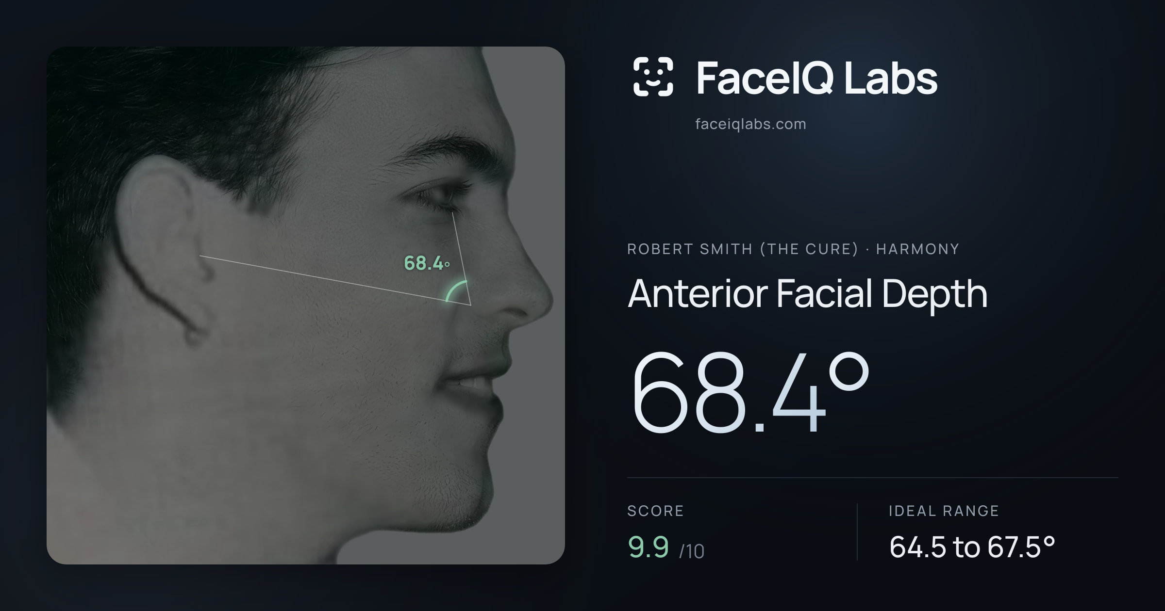 Robert Smith (The cure) Anterior Facial Depth: 68.4°, drawn on the photo