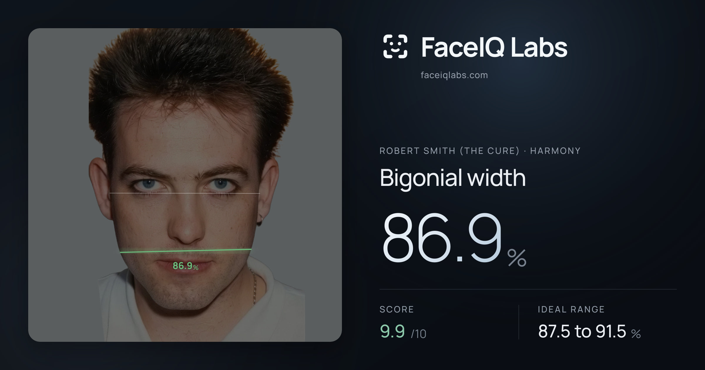 Robert Smith (The cure) Bigonial width: 86.9%, drawn on the photo