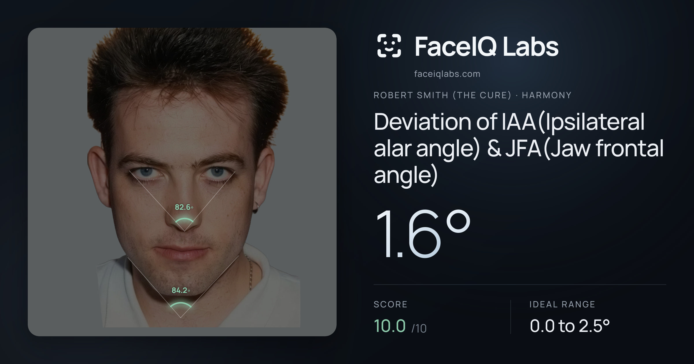Robert Smith (The cure) Deviation of IAA(Ipsilateral alar angle) & JFA(Jaw frontal angle): 1.6°, drawn on the photo