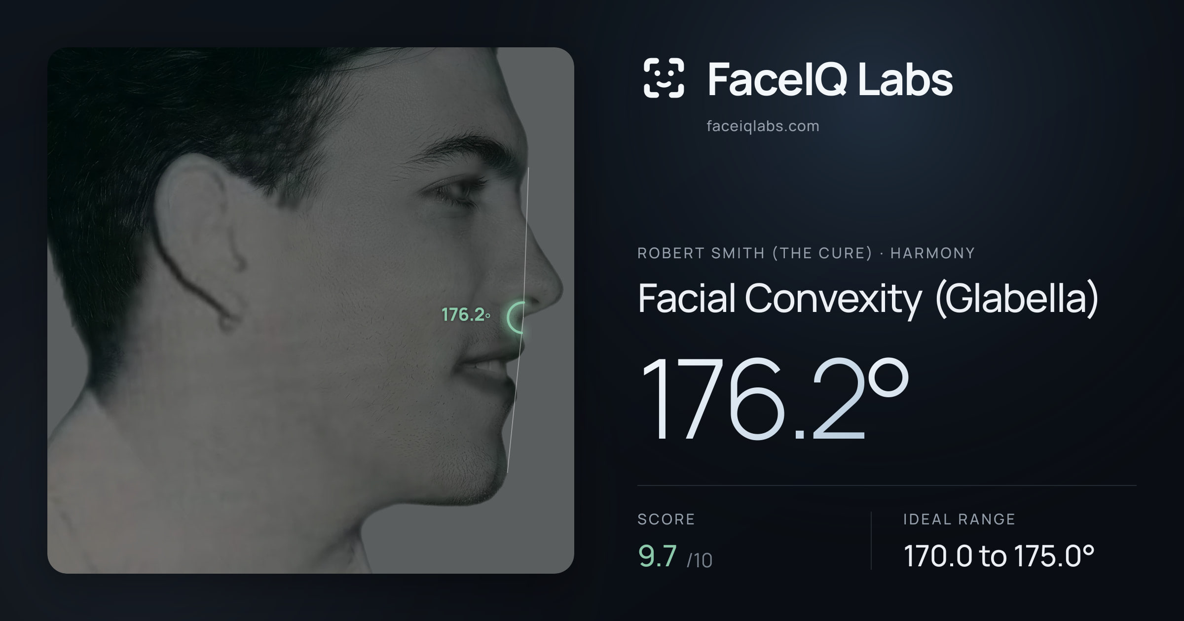 Robert Smith (The cure) Facial Convexity (Glabella): 176.2°, drawn on the photo