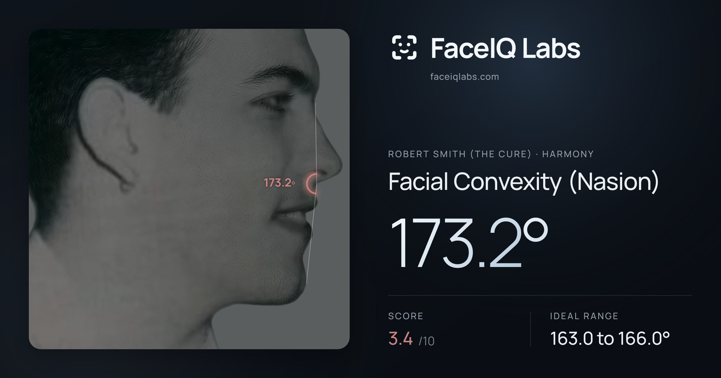Robert Smith (The cure) Facial Convexity (Nasion): 173.2°, drawn on the photo