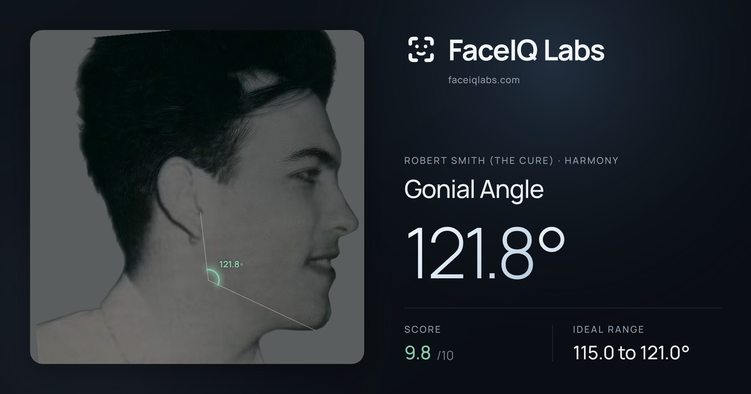 Robert Smith (The cure) Gonial Angle: 121.8°, drawn on the photo