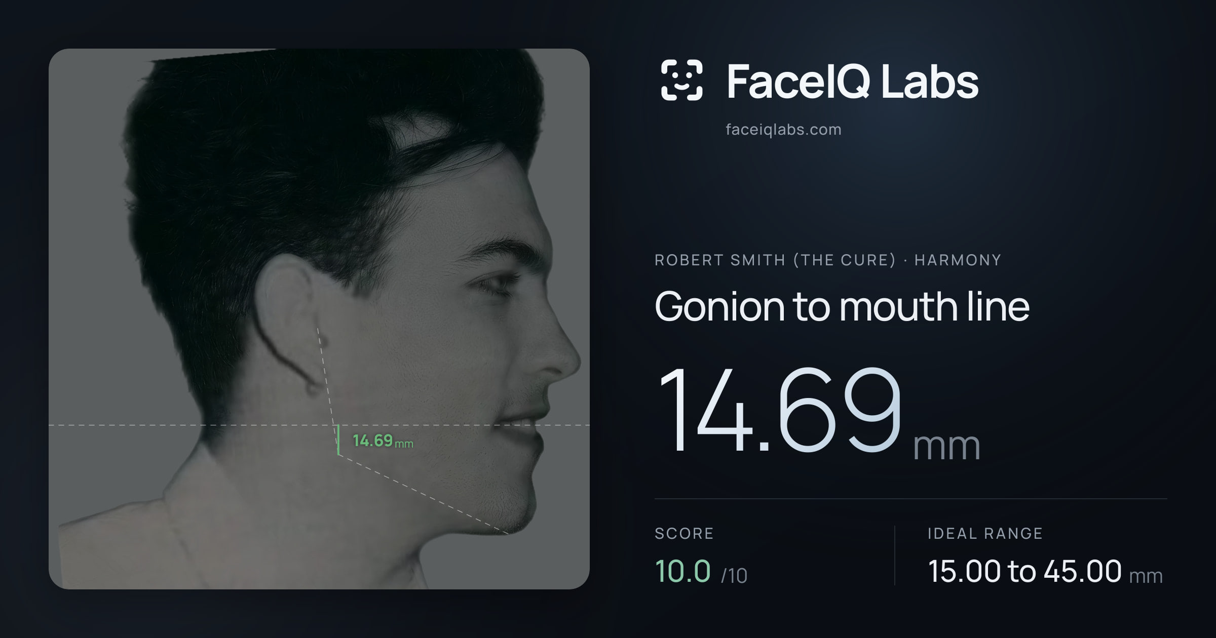 Robert Smith (The cure) Gonion to mouth line: 14.69mm, drawn on the photo