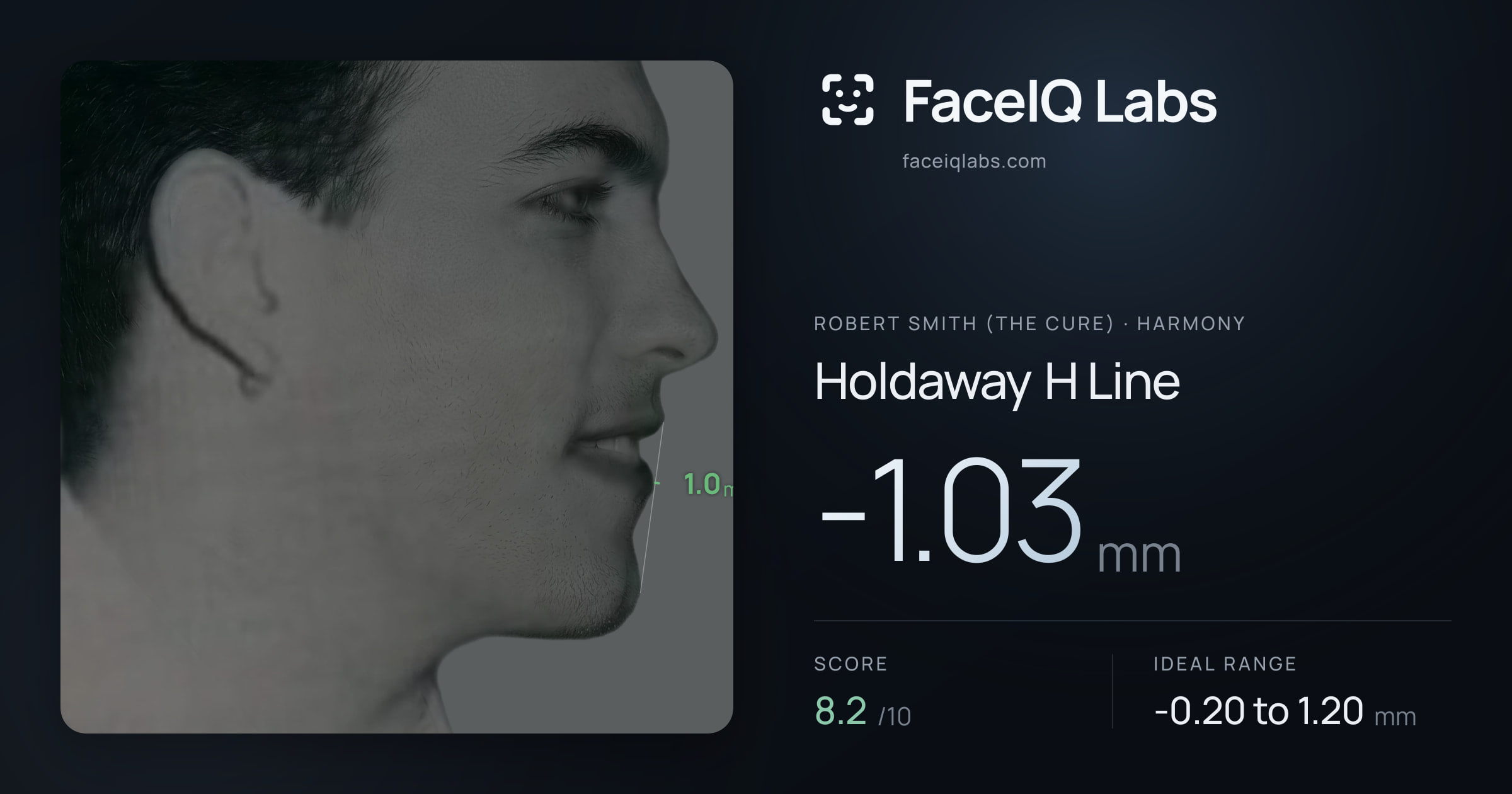 Robert Smith (The cure) Holdaway H Line: -1.03mm, drawn on the photo