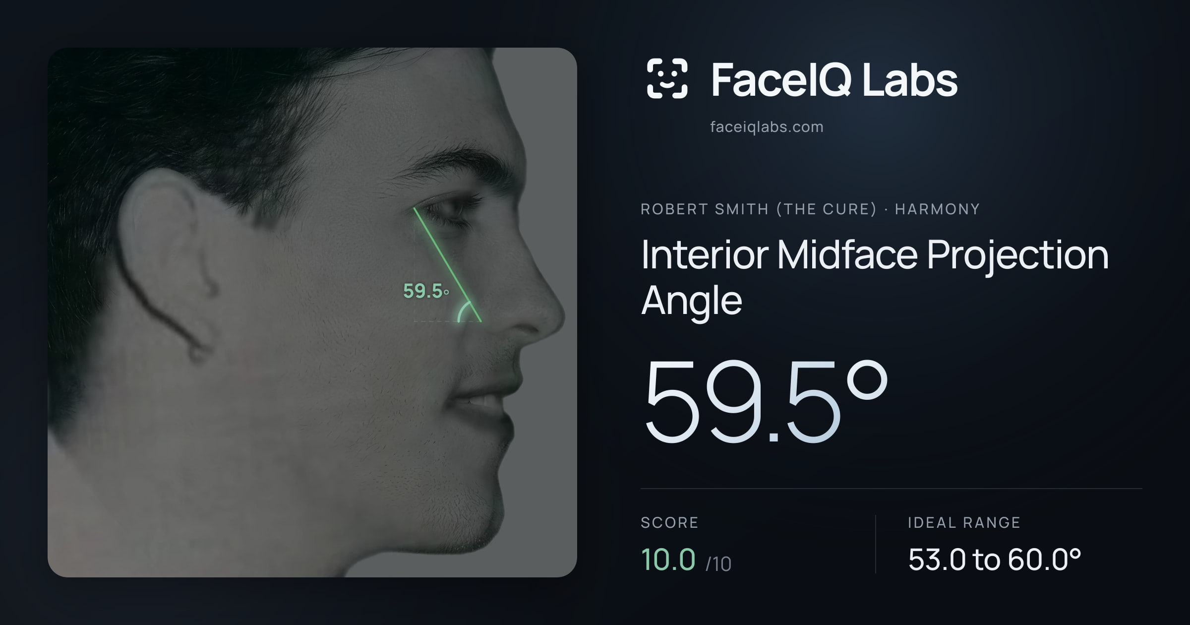 Robert Smith (The cure) Interior Midface Projection Angle: 59.5°, drawn on the photo