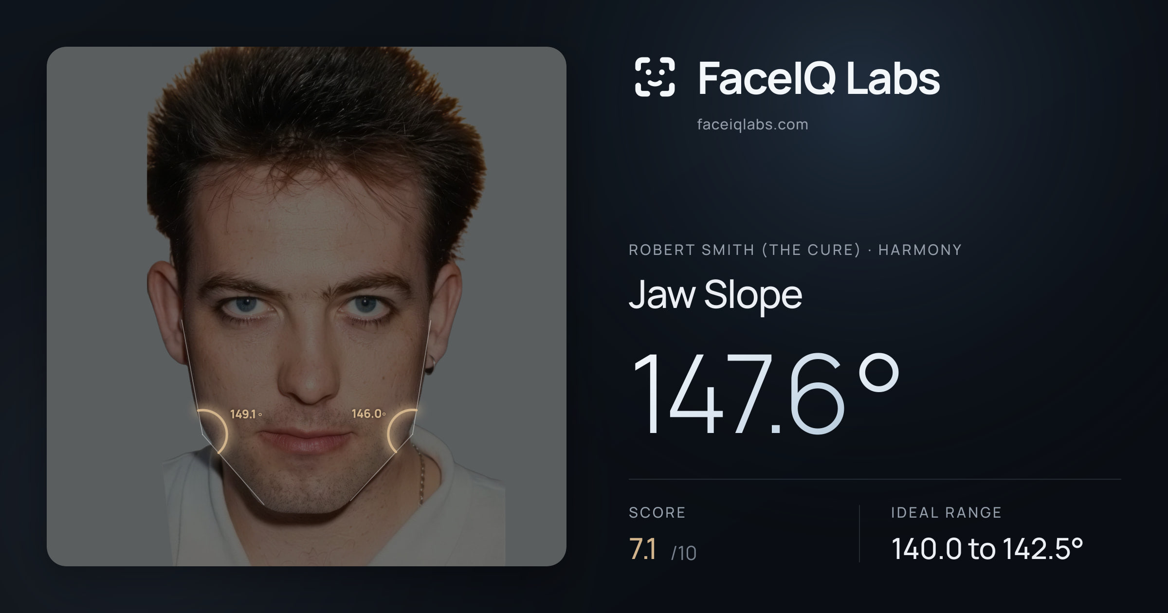 Robert Smith (The cure) Jaw Slope: 147.6°, drawn on the photo
