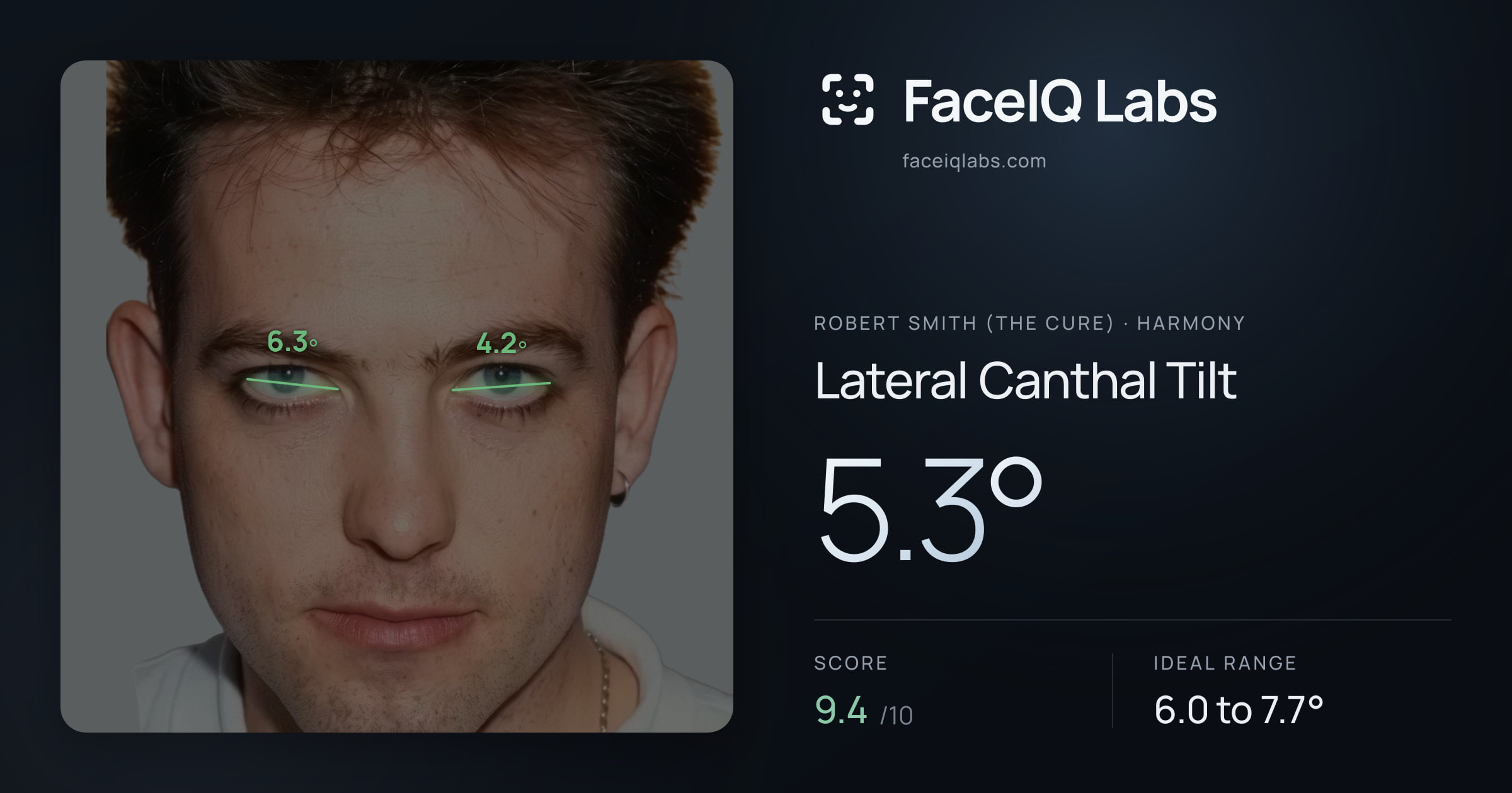 Robert Smith (The cure) Lateral Canthal Tilt: 5.3°, drawn on the photo