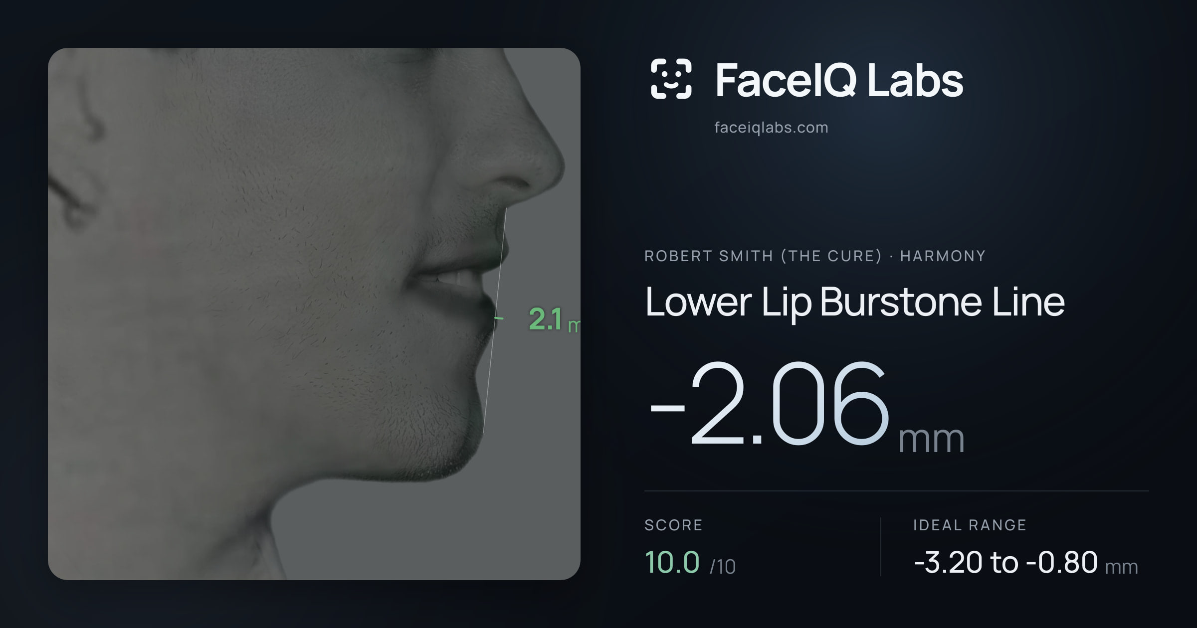 Robert Smith (The cure) Lower Lip Burstone Line: -2.06mm, drawn on the photo