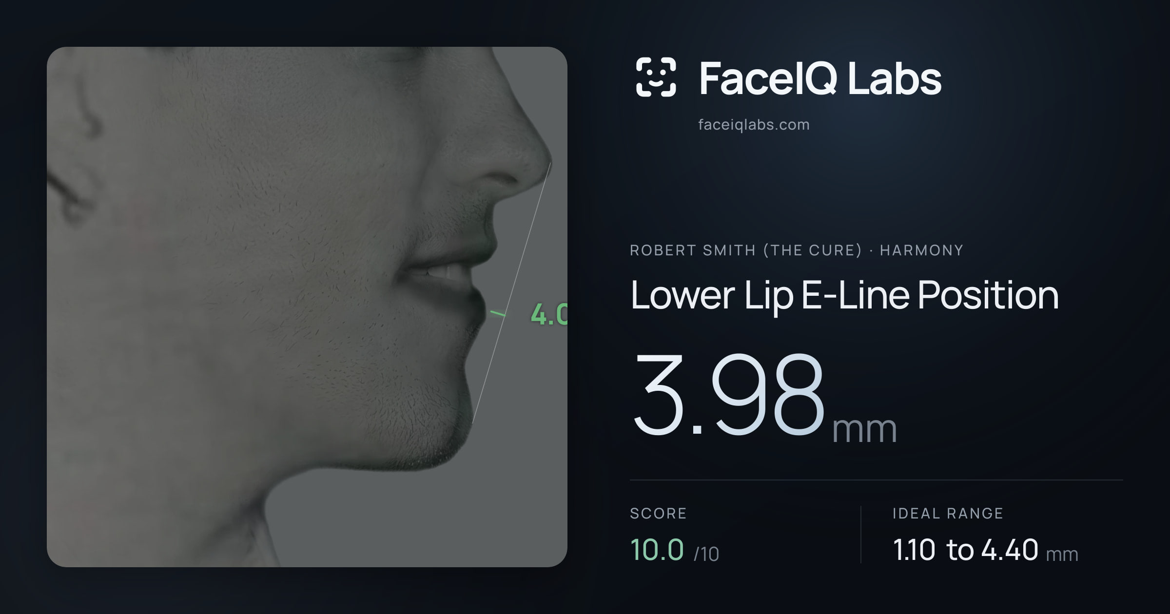 Robert Smith (The cure) Lower Lip E-Line Position: 3.98mm, drawn on the photo