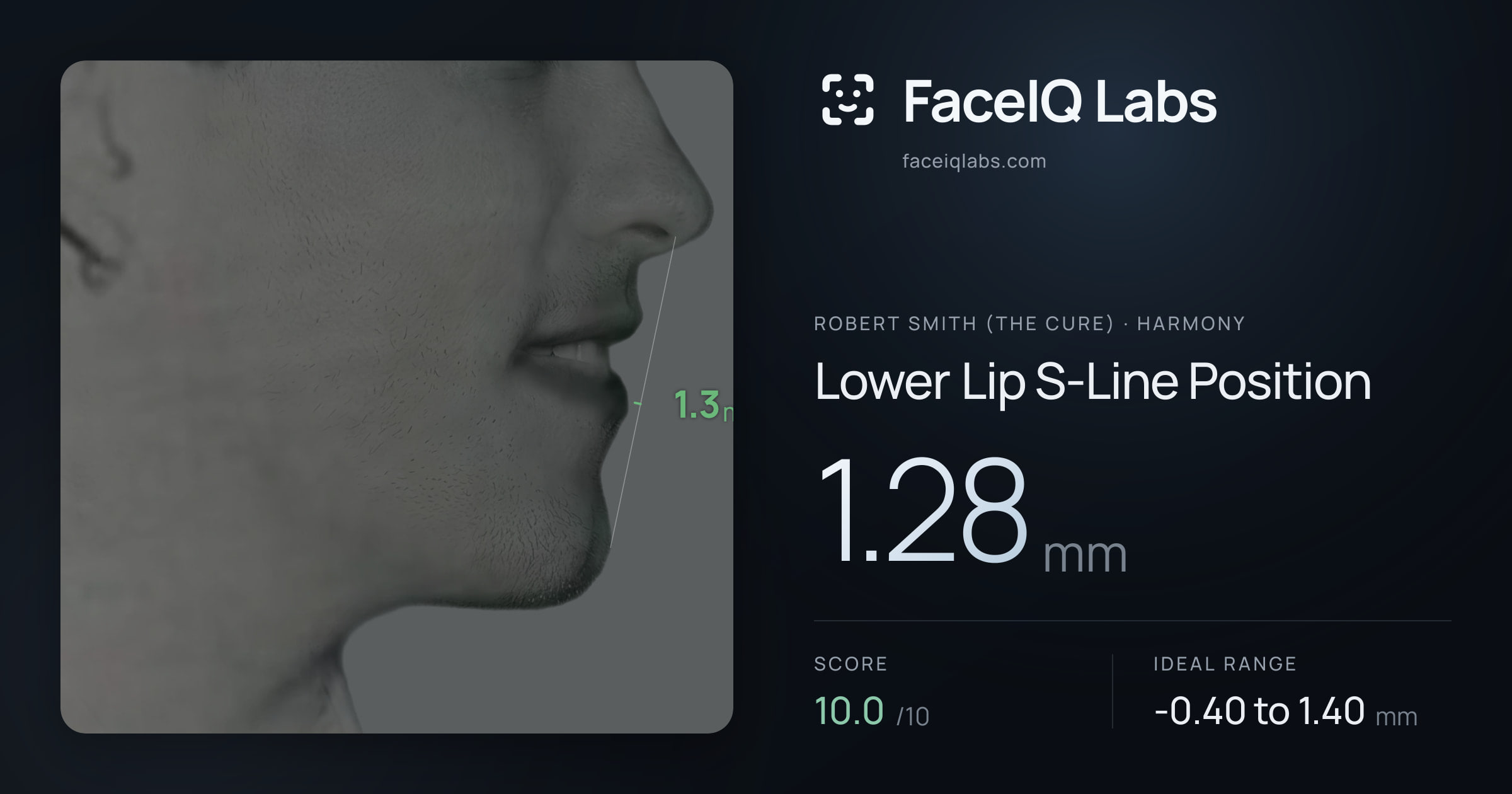Robert Smith (The cure) Lower Lip S-Line Position: 1.28mm, drawn on the photo