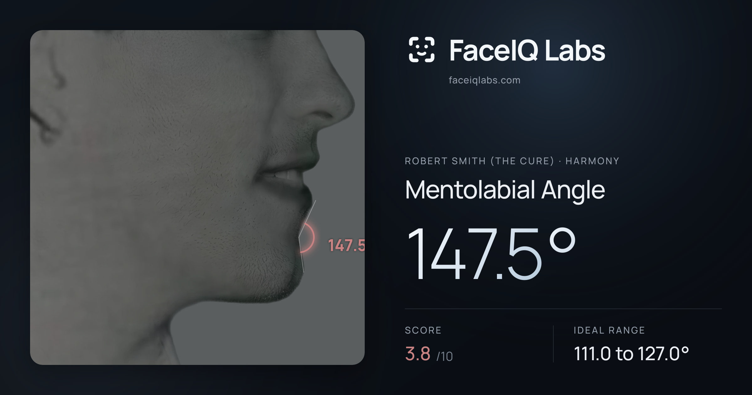 Robert Smith (The cure) Mentolabial Angle: 147.5°, drawn on the photo
