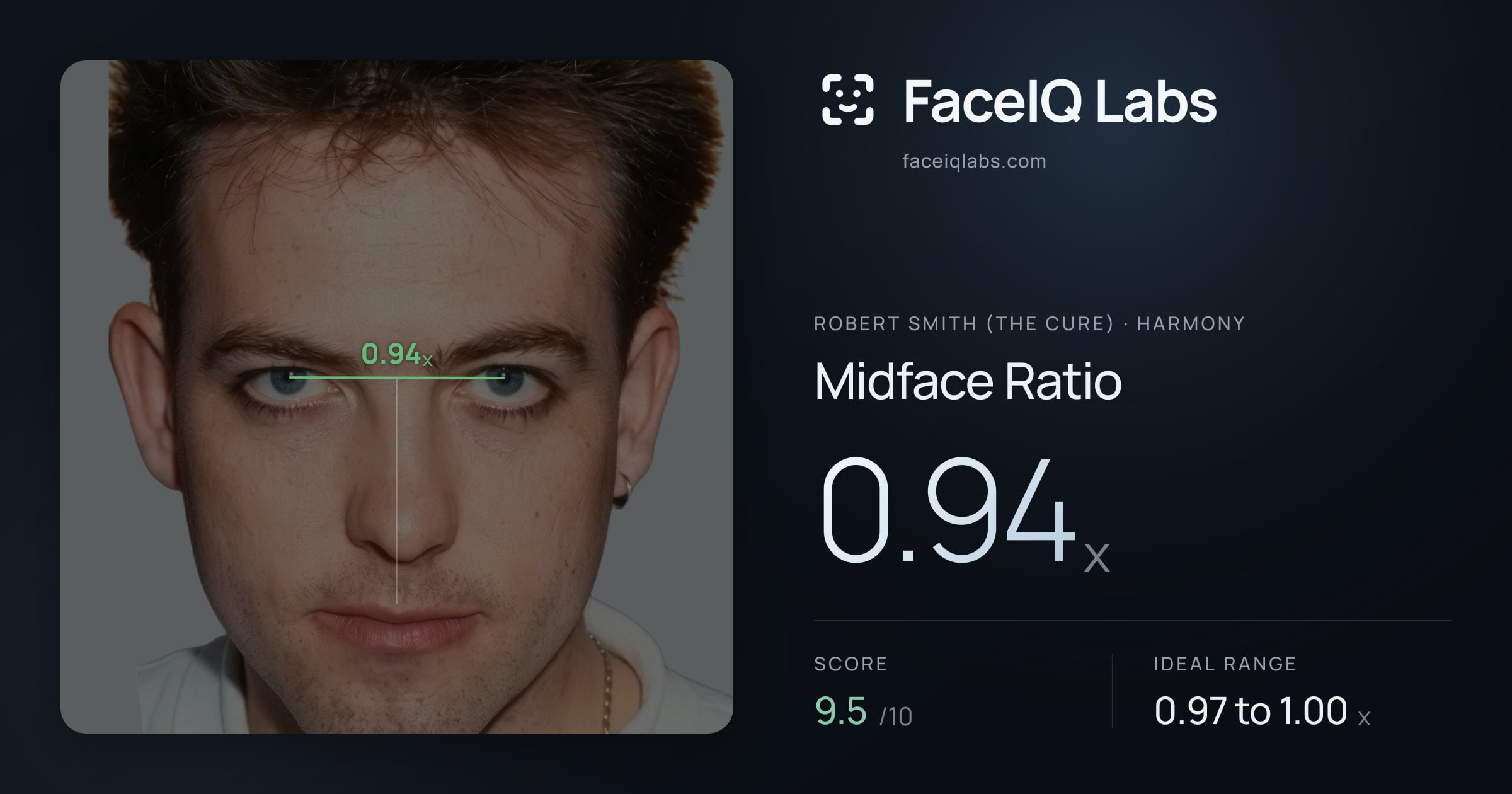 Robert Smith (The cure) Midface Ratio: 0.94x, drawn on the photo