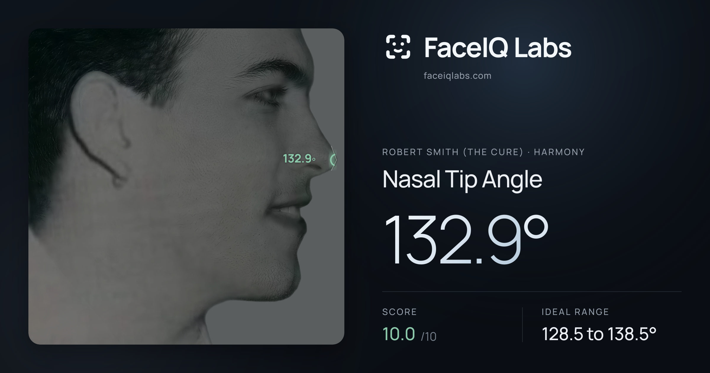 Robert Smith (The cure) Nasal Tip Angle: 132.9°, drawn on the photo