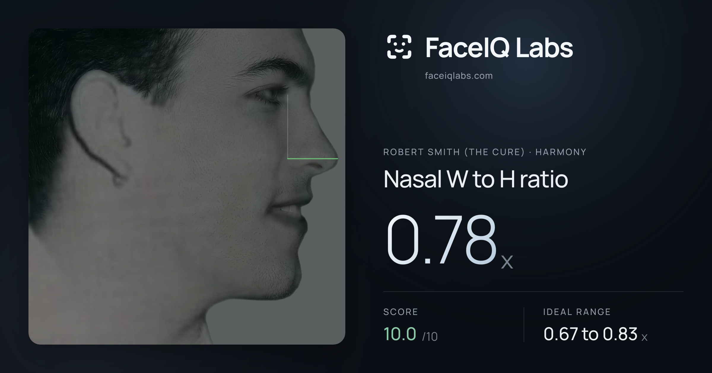 Robert Smith (The cure) Nasal W to H ratio: 0.78x, drawn on the photo