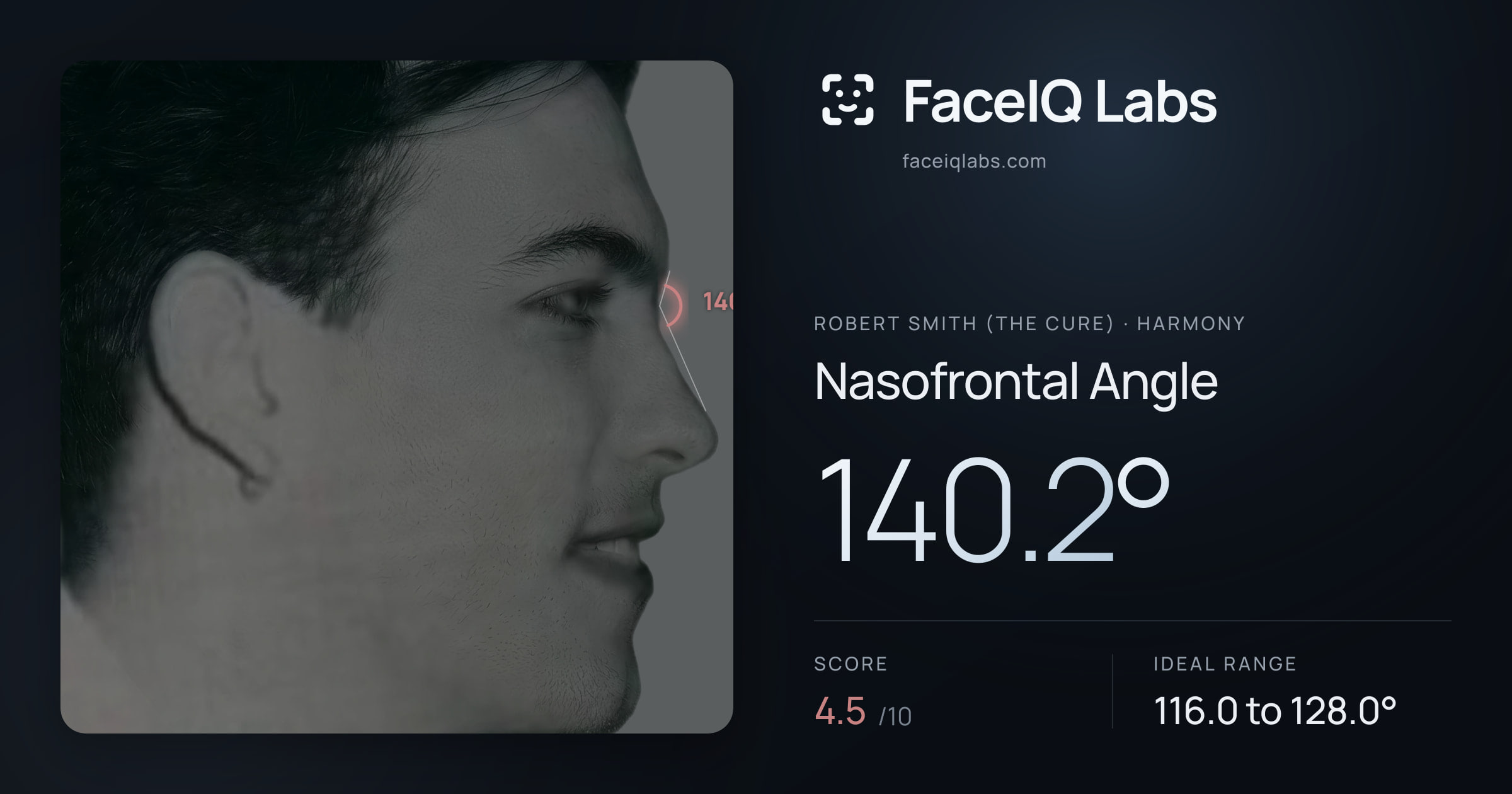 Robert Smith (The cure) Nasofrontal Angle: 140.2°, drawn on the photo