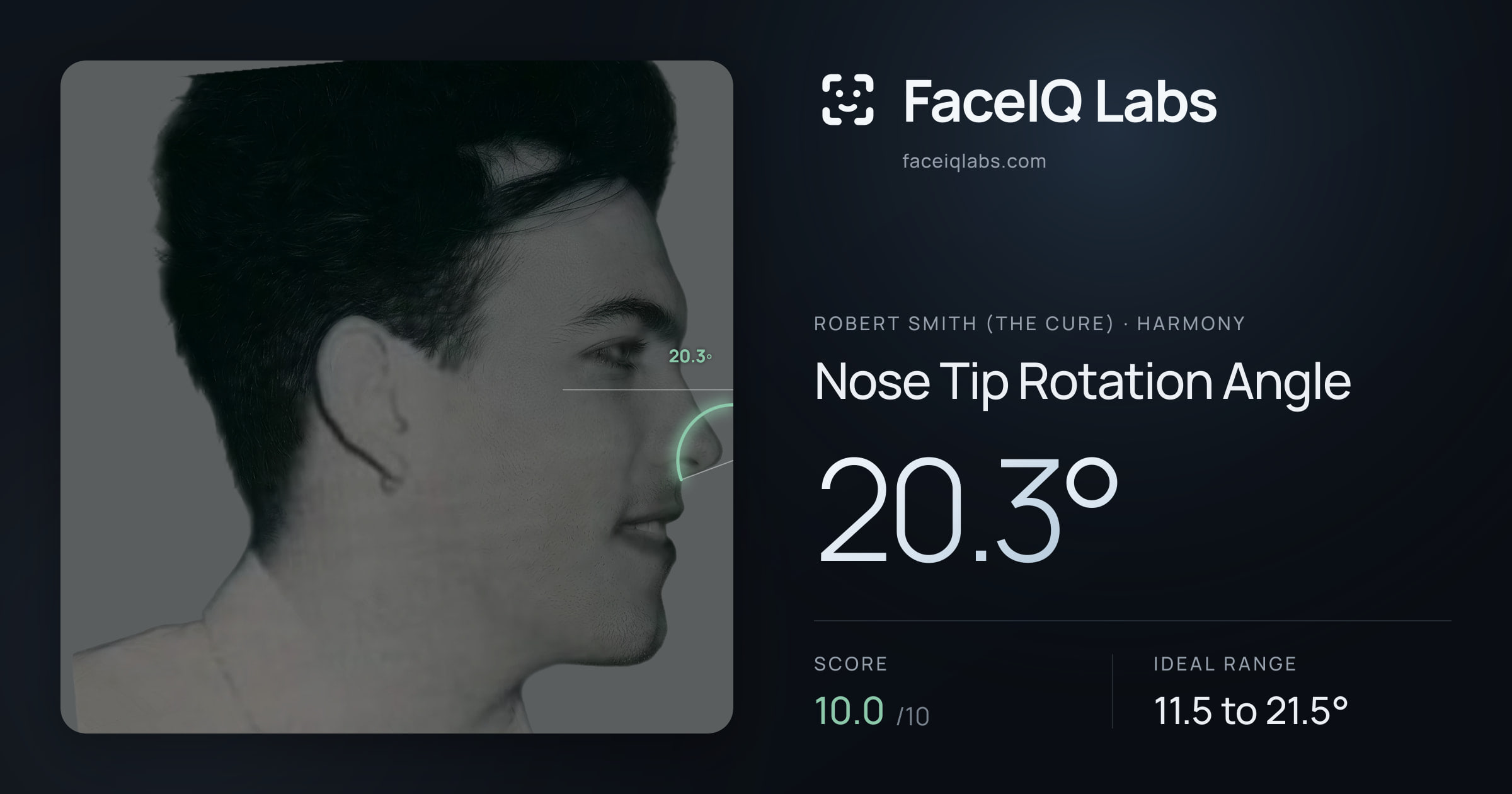 Robert Smith (The cure) Nose Tip Rotation Angle: 20.3°, drawn on the photo