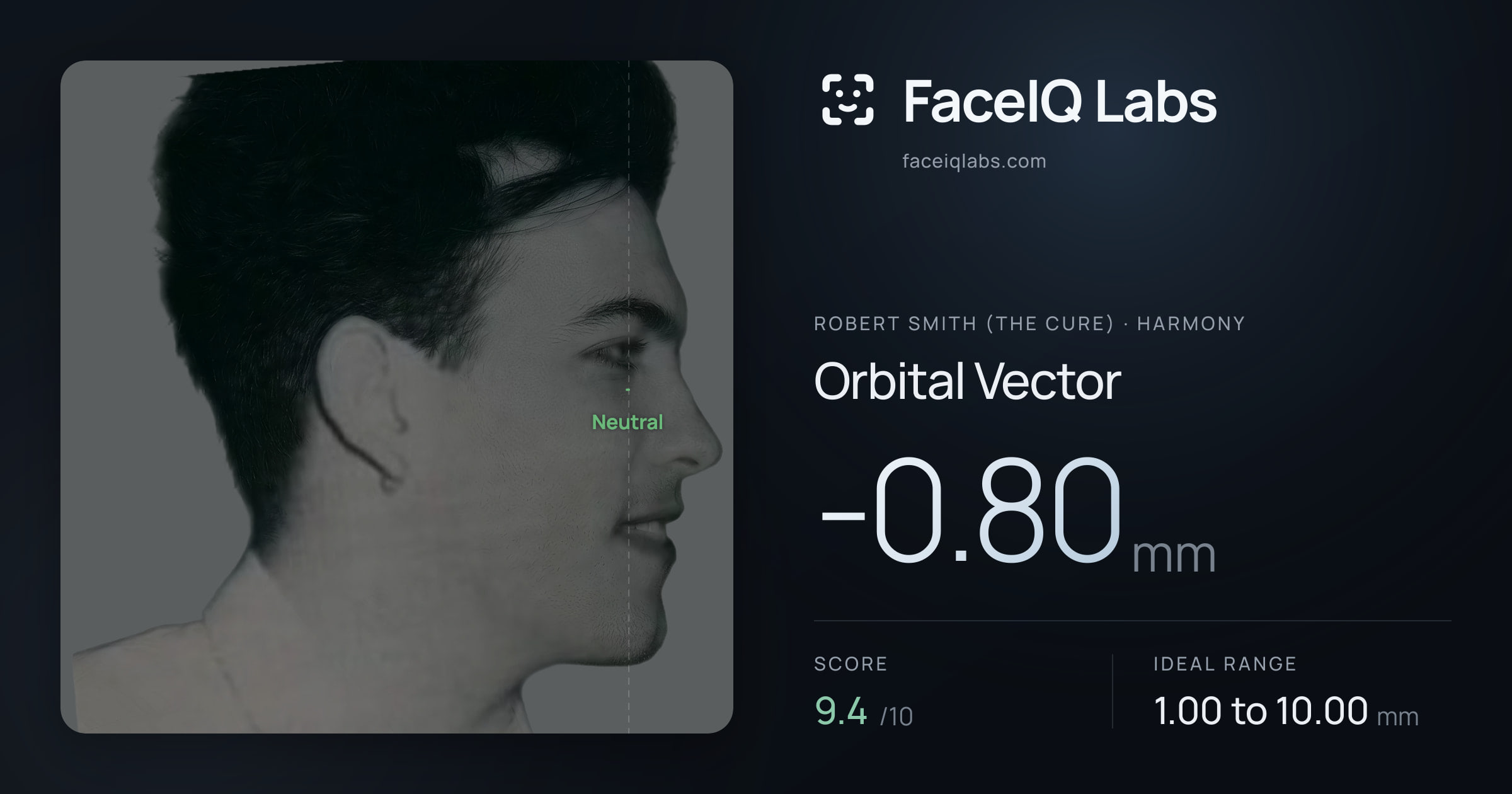 Robert Smith (The cure) Orbital Vector: -0.80mm, drawn on the photo