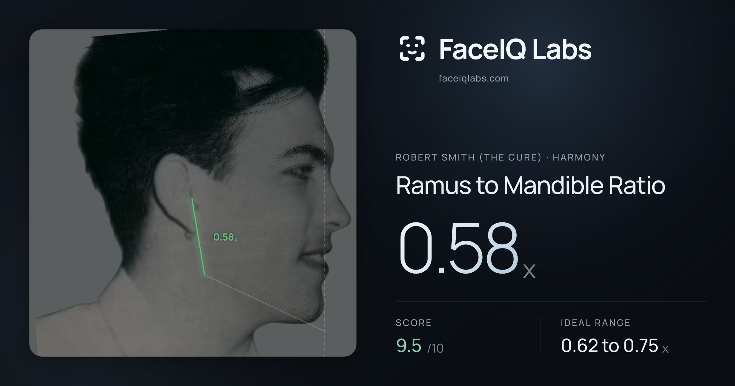 Robert Smith (The cure) Ramus to Mandible Ratio: 0.58x, drawn on the photo