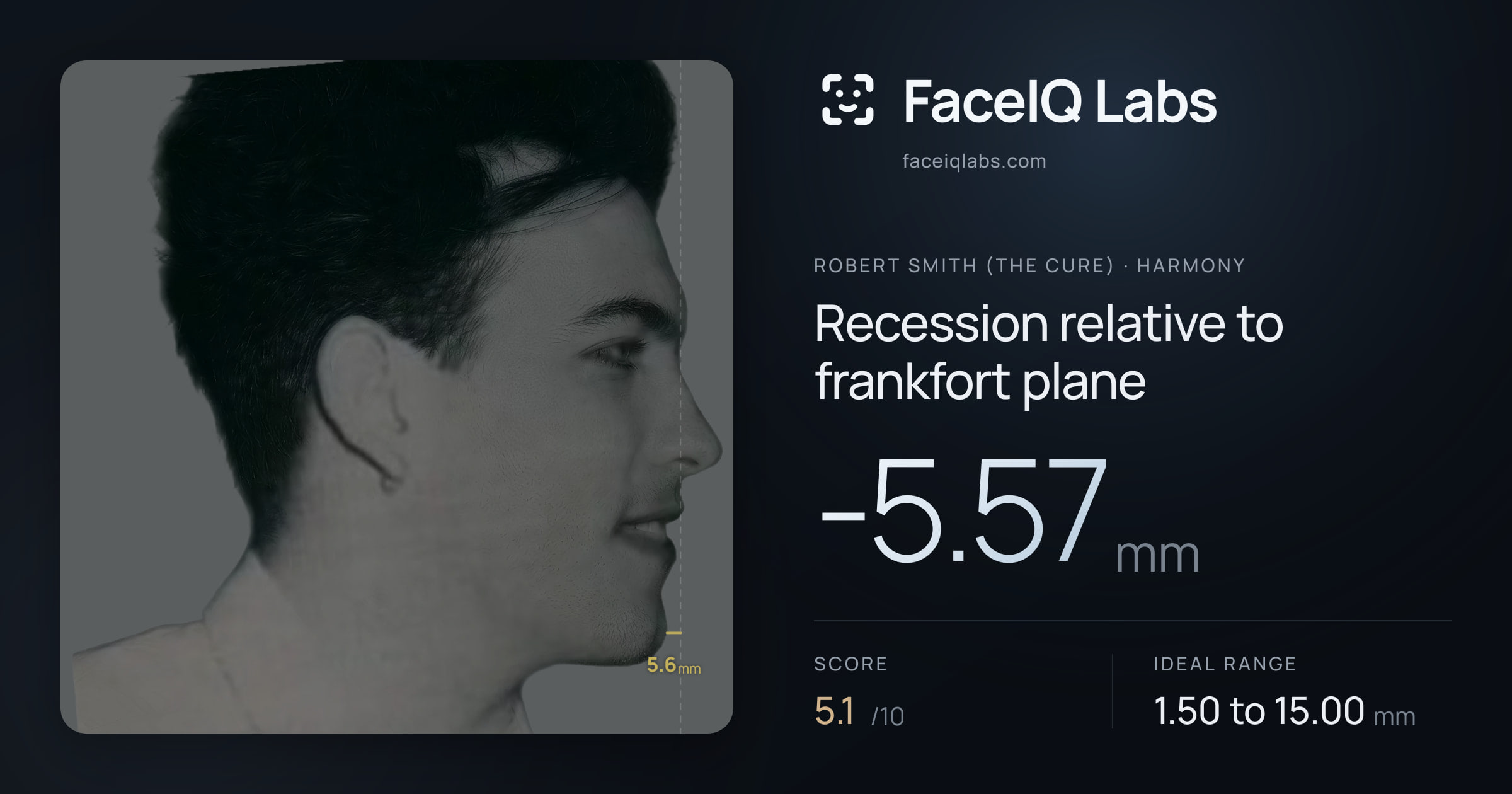 Robert Smith (The cure) Recession relative to frankfort plane: -5.57mm, drawn on the photo