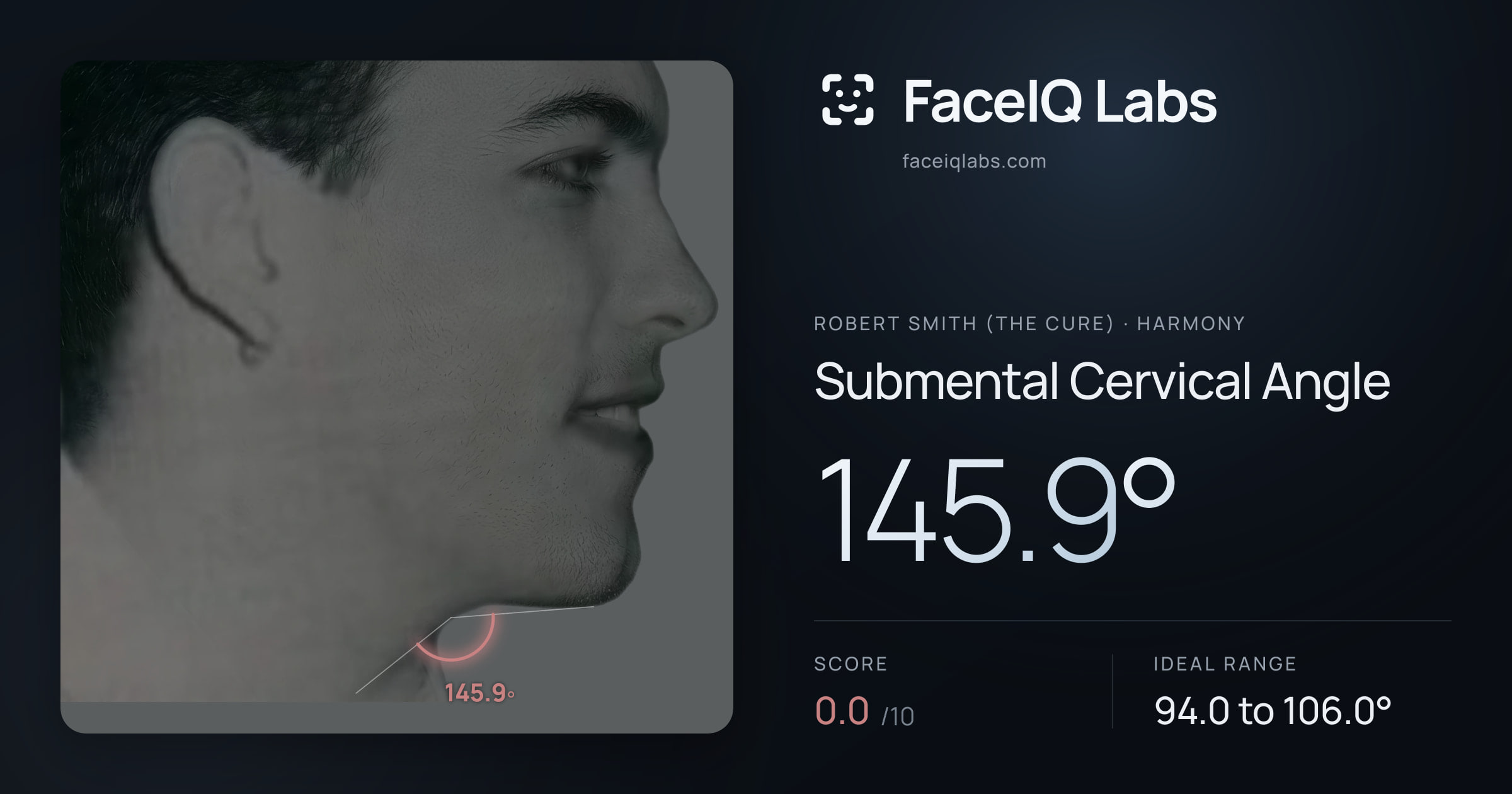 Robert Smith (The cure) Submental Cervical Angle: 145.9°, drawn on the photo