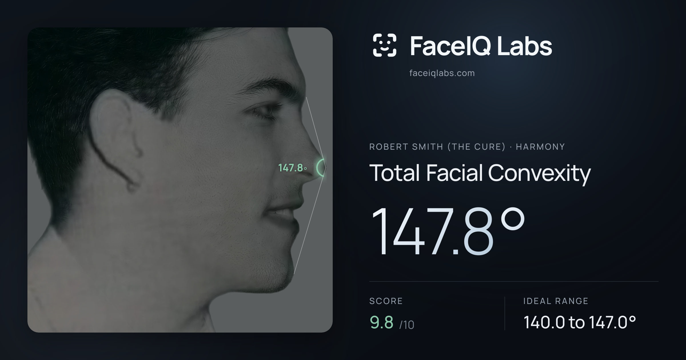 Robert Smith (The cure) Total Facial Convexity: 147.8°, drawn on the photo