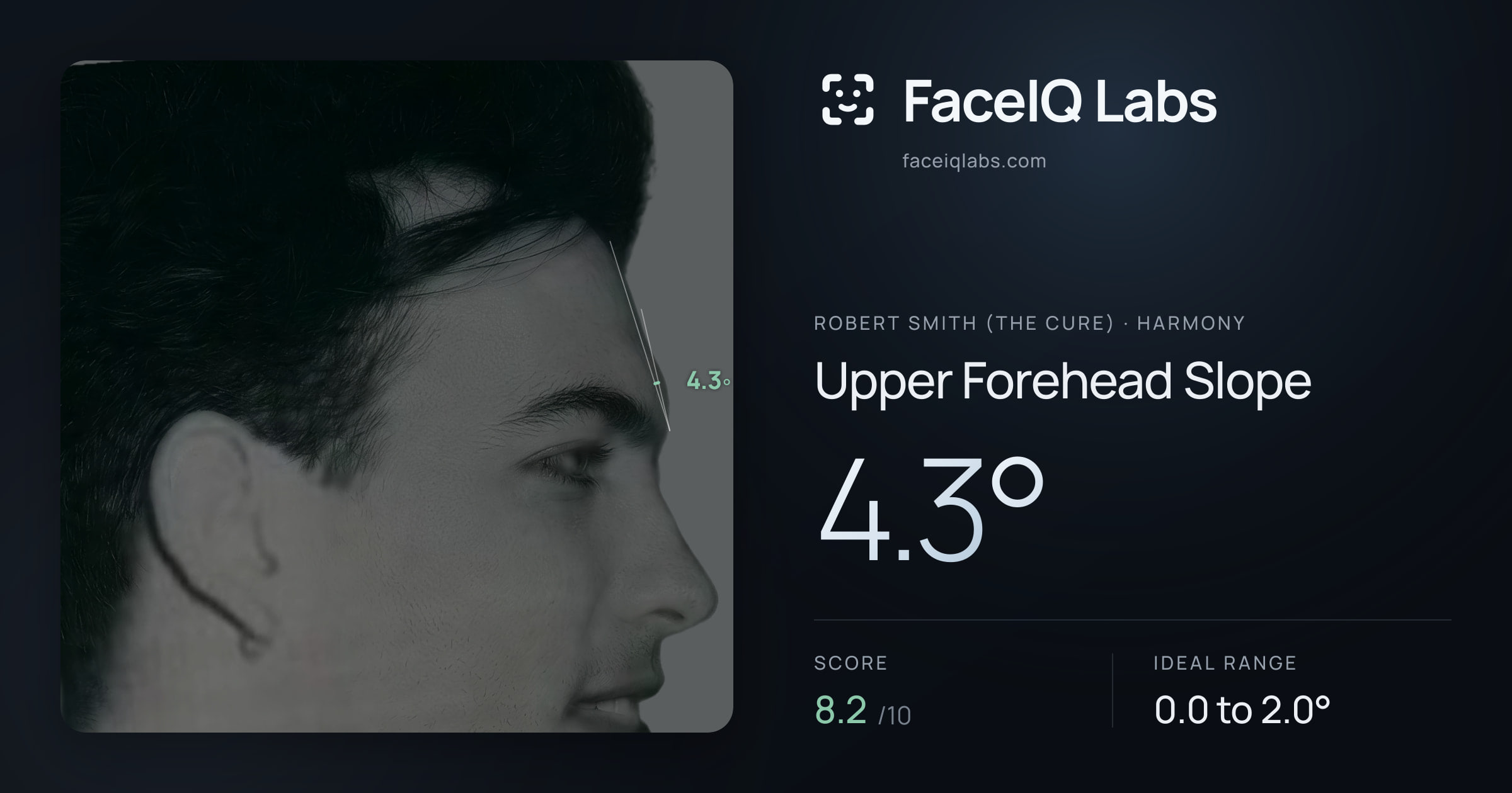 Robert Smith (The cure) Upper Forehead Slope: 4.3°, drawn on the photo